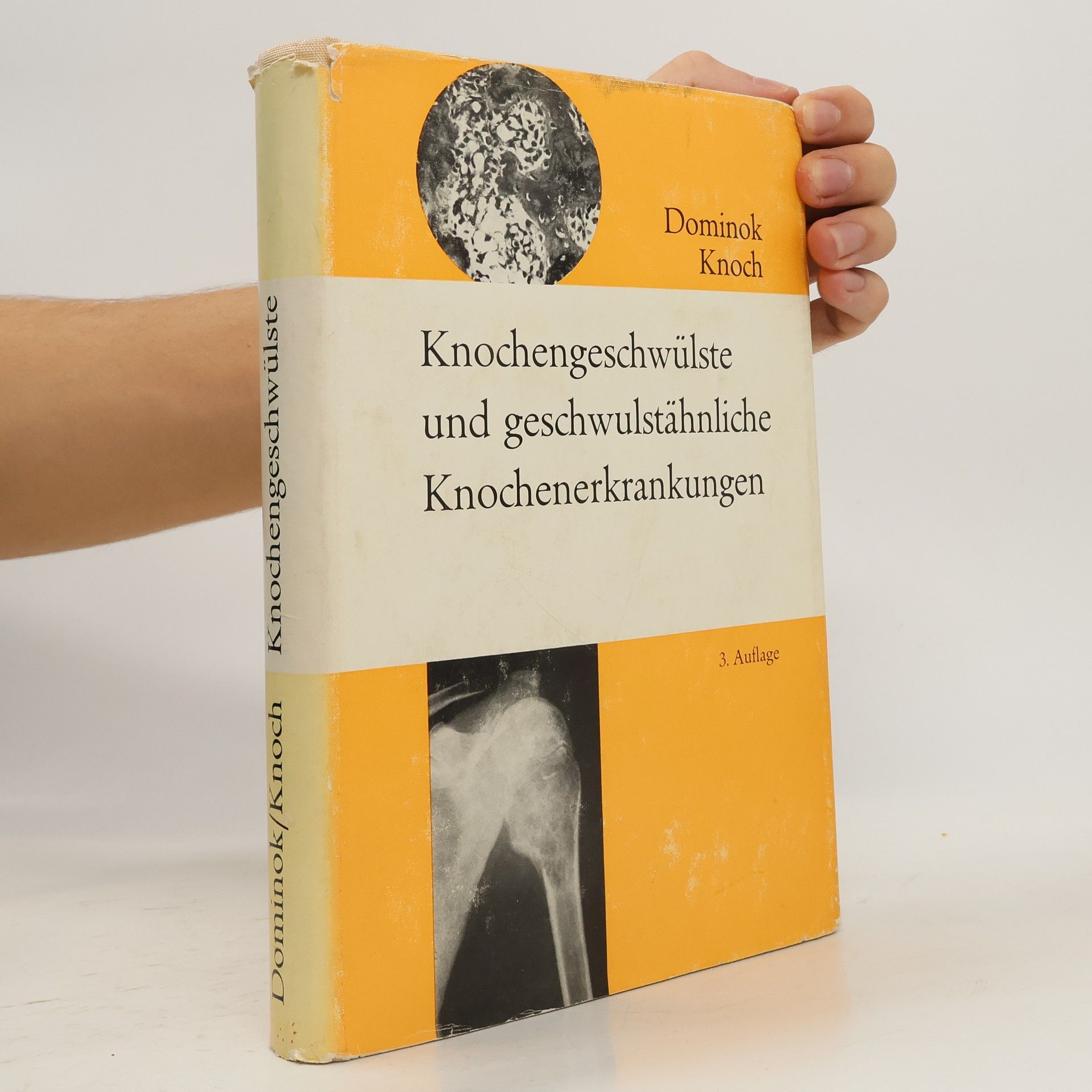 Dominok Knoch Knochengeschwülste und geschwulstähnliche Knochenerkrankungen
