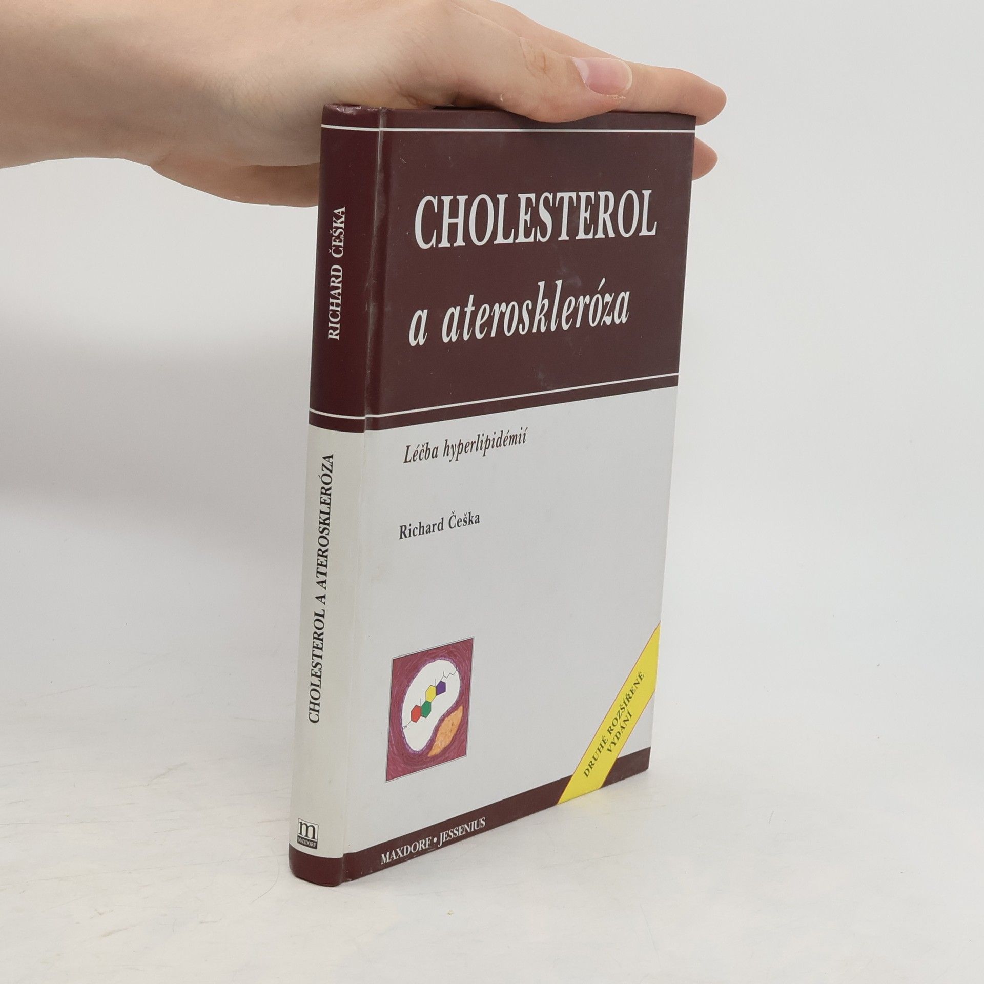 Richard Češka Cholesterol a ateroskleróza: Léčba hyperlipidémií