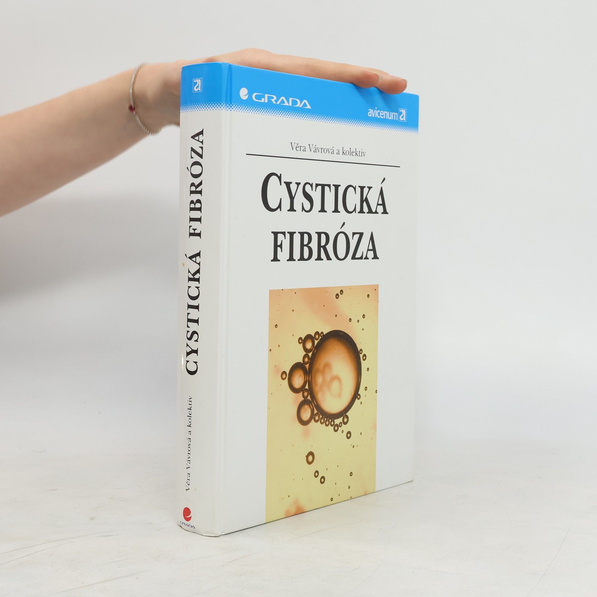 Věra Vávrová Cystická fibróza