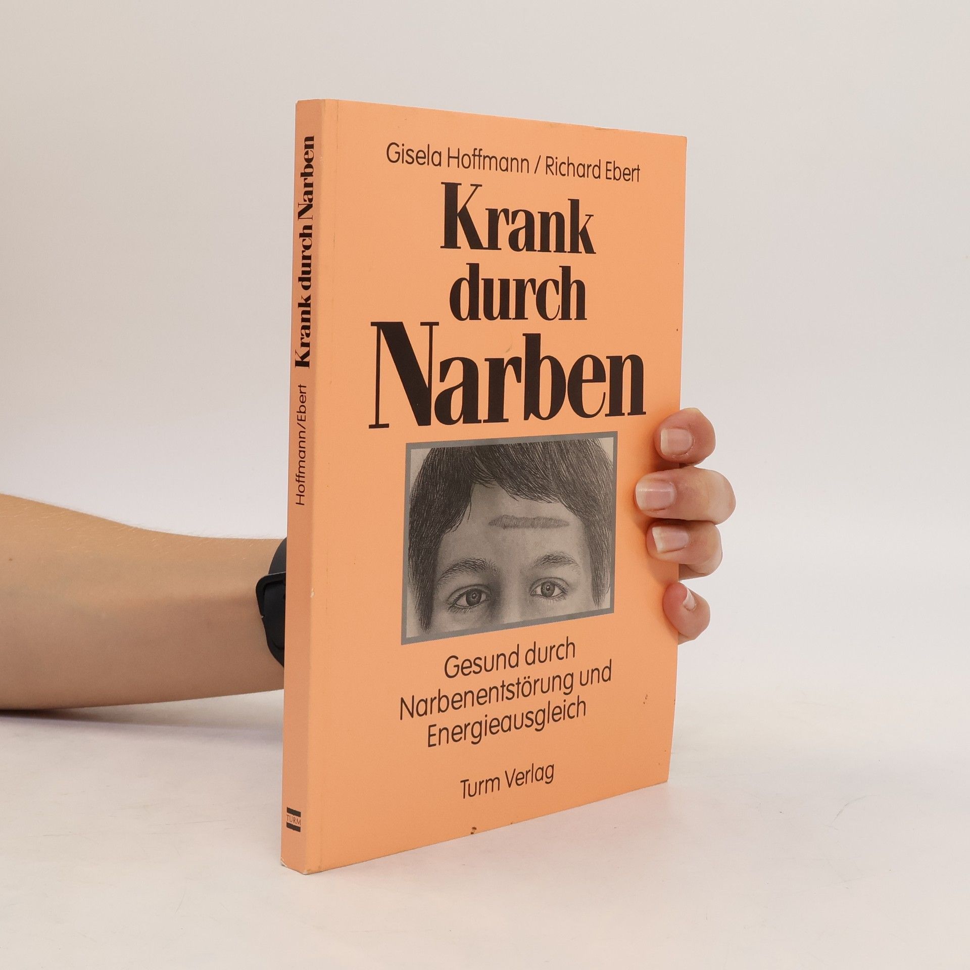 Gisela Hoffmann Krank durch Narben