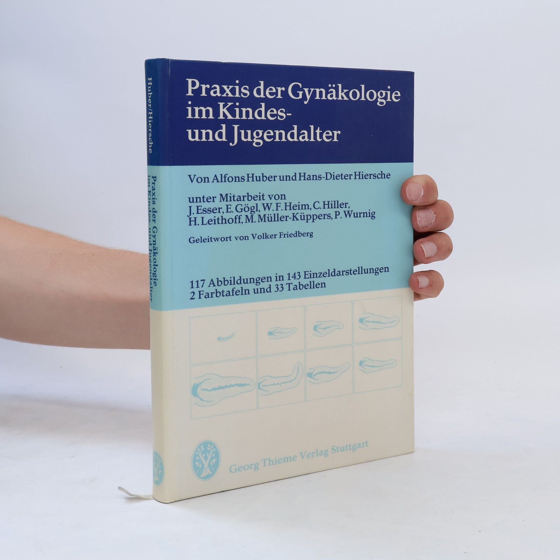 Alfons Huber Praxis der Gynäkologie im Kindes- und Jugendalter