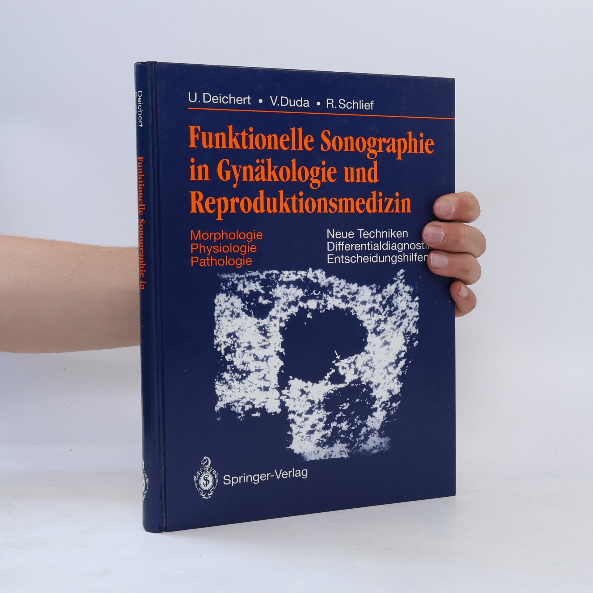 Ulrich Deichert Funktionelle Sonographie in Gynäkologie und Reproduktionsmedizin
