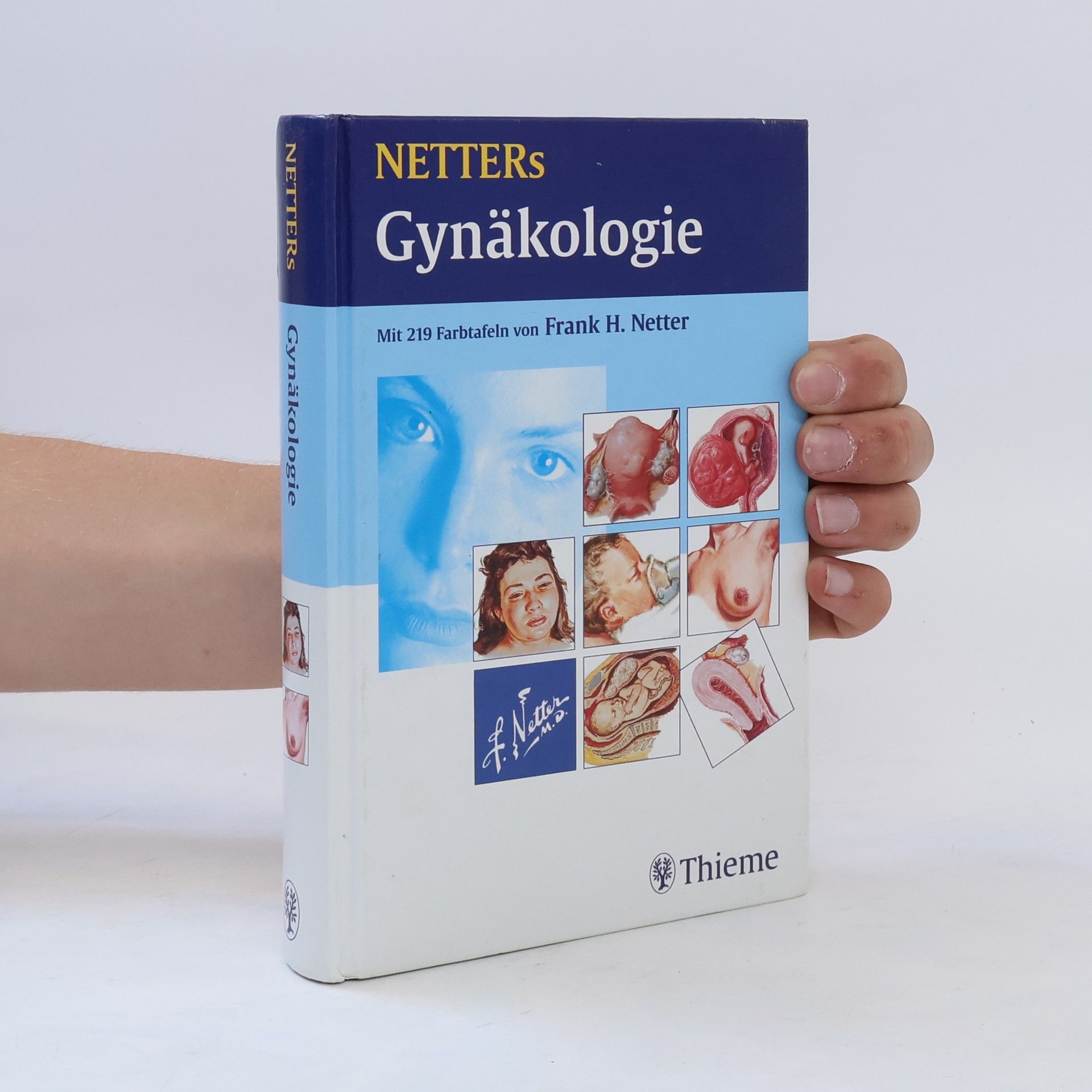Frank H. Netter Netters Gynäkologie
