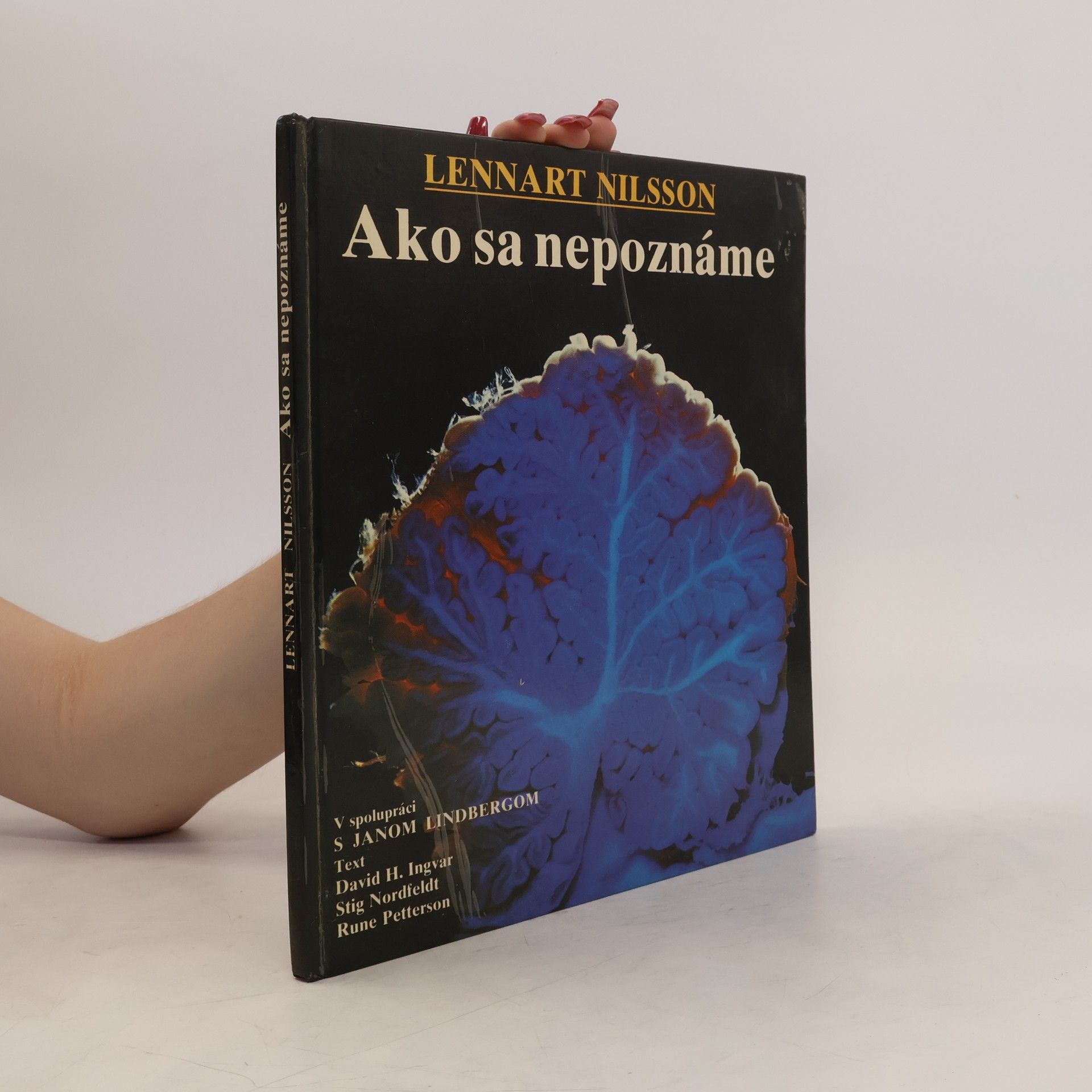 Collectif d'auteurs Ako sa nepoznáme: Objavná cesta s fotografickým aparátom do nášho tela
