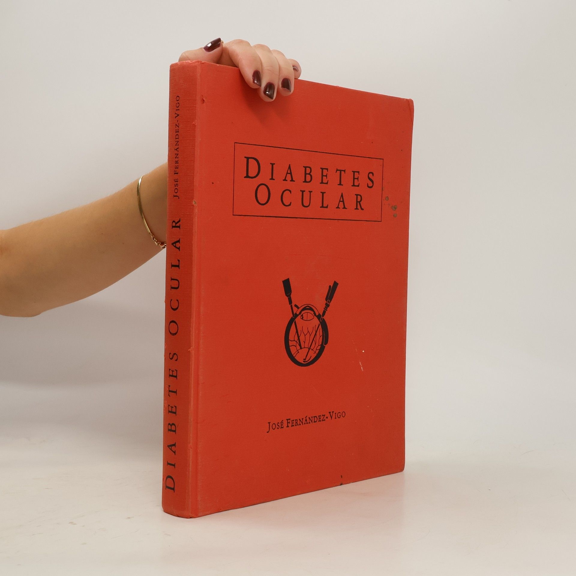 José Fernández-Vigo Diabetes ocular