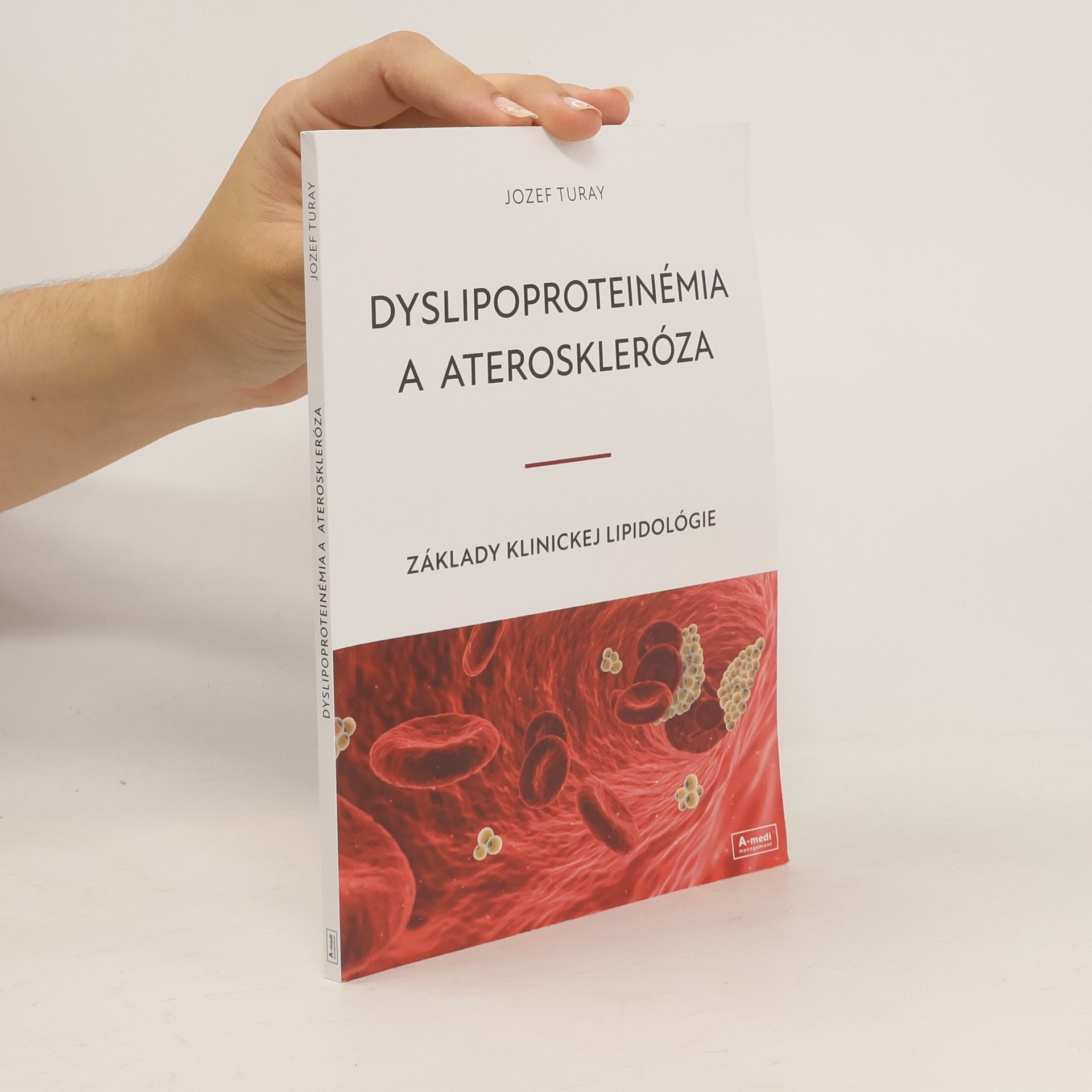 Jozef Turay Dyslipoproteinémia a ateroskleróza