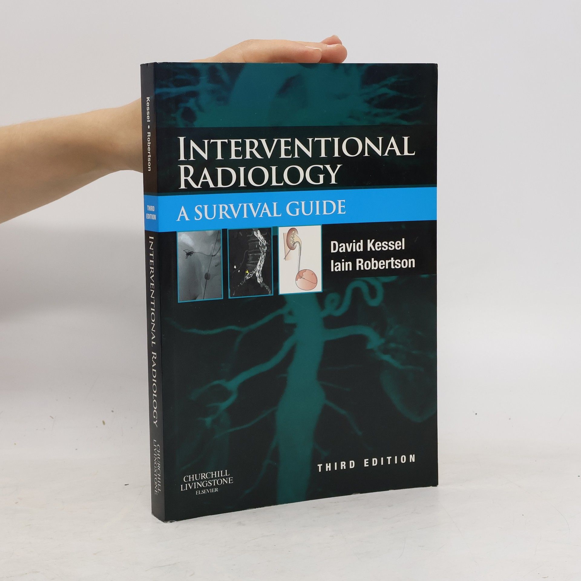 David O. Kessel Interventional Radiology