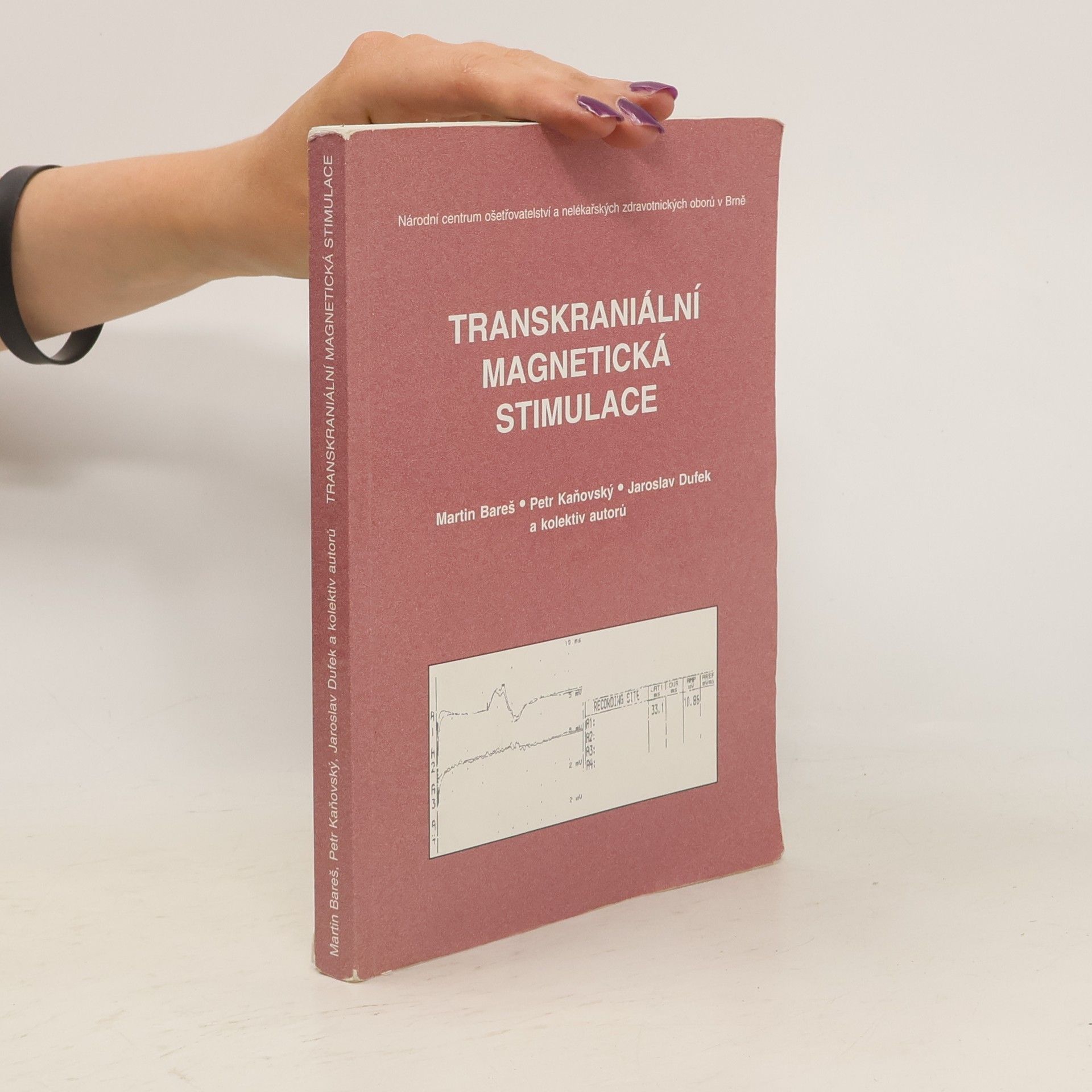 Martin Bareš Transkraniální magnetická stimulace