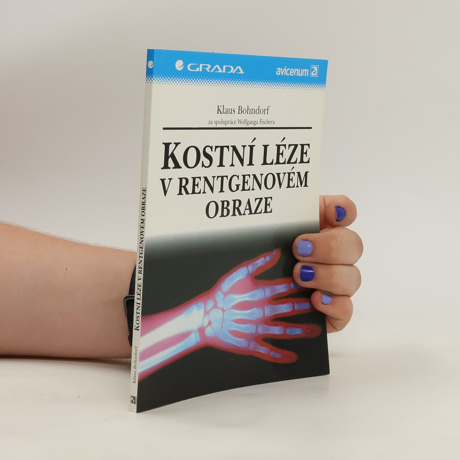 Klaus Bohndorf Kostní léze v rentgenovém obraze