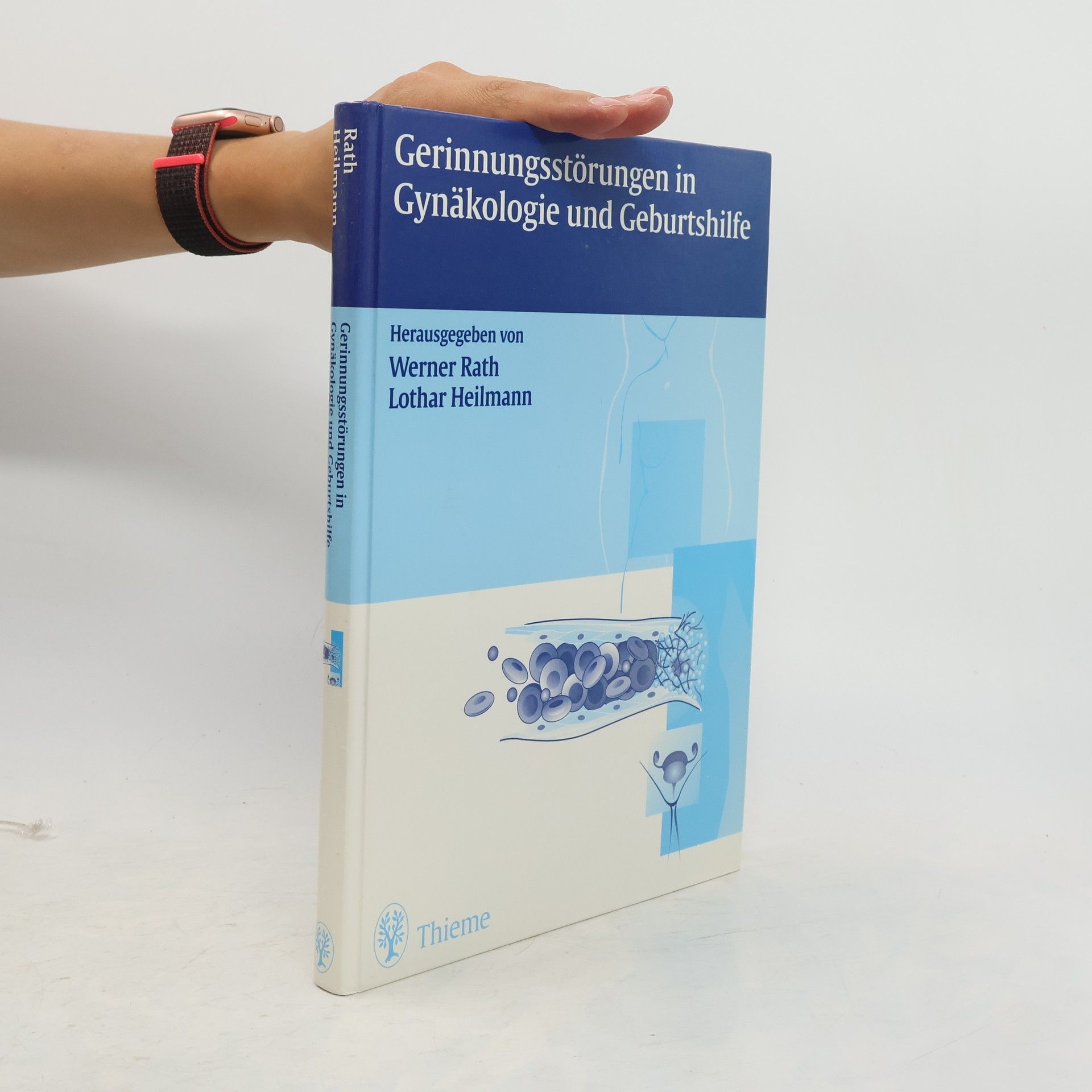 Werner Rath Gerinnungsstörungen in Gynäkologie und Geburtshilfe