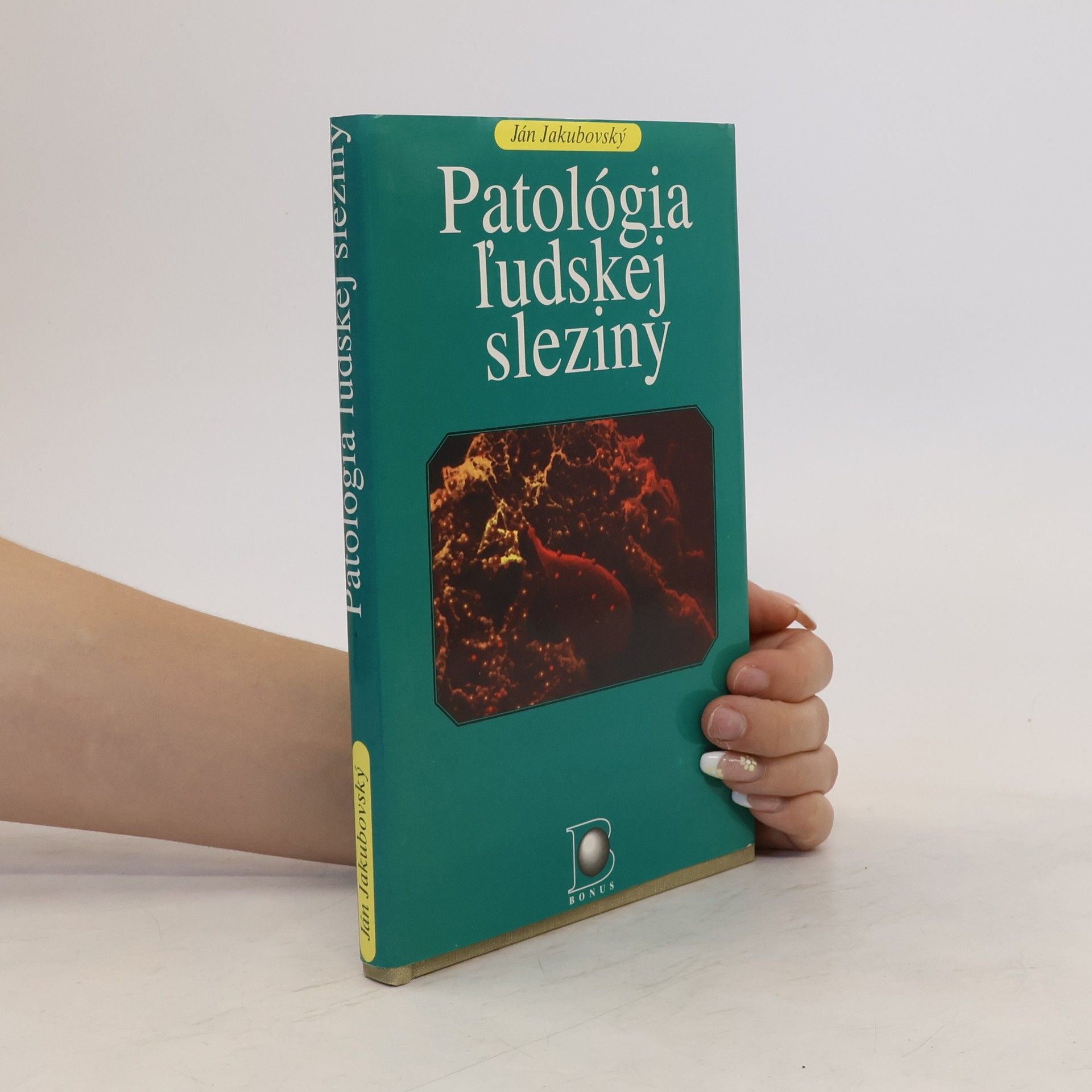 Ján Jakubovský Patológia ľudskej sleziny