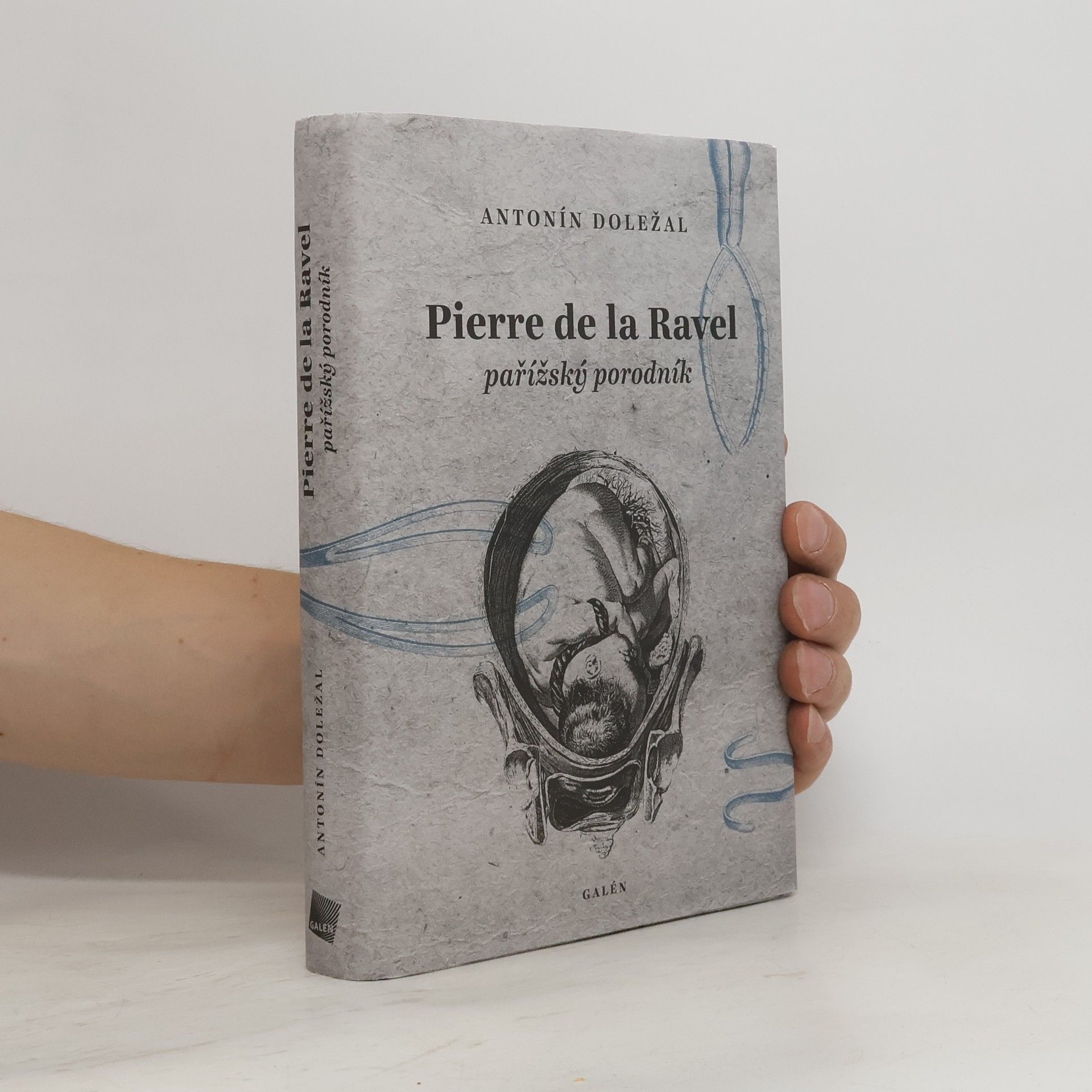Antonín Doležal Pierre de la Ravel : pařížský porodník