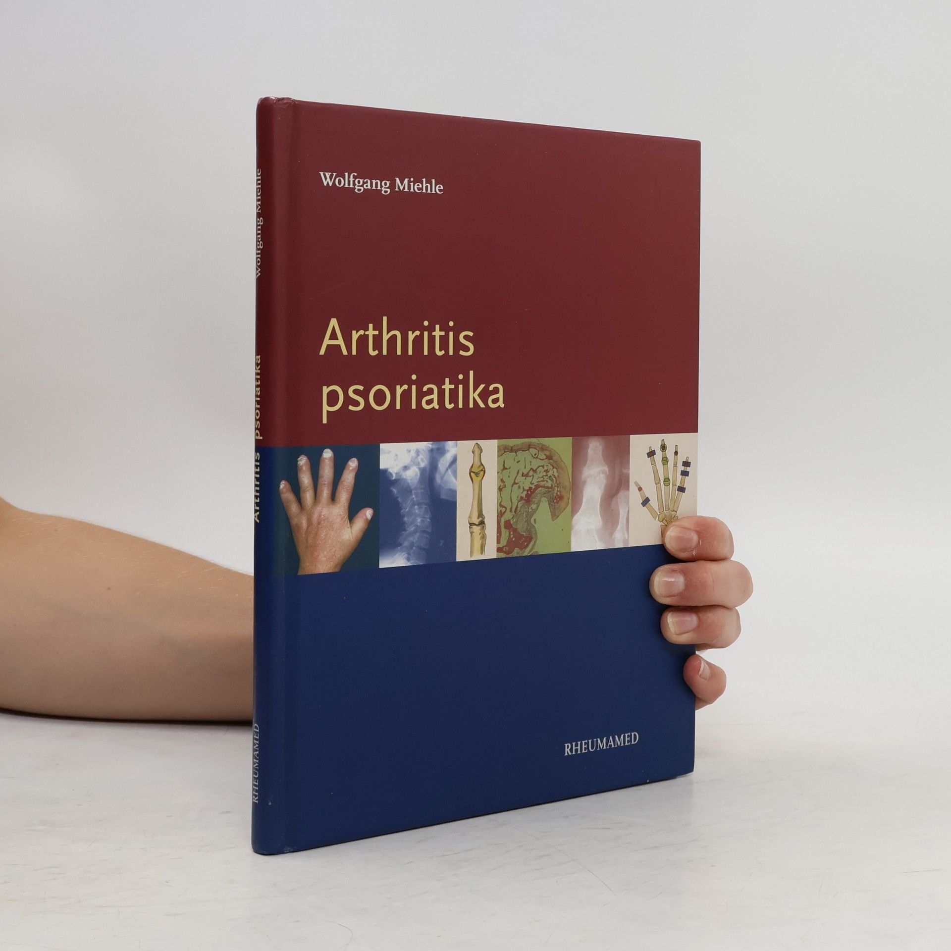 Wolfgang Miehle Arthritis psoriatika