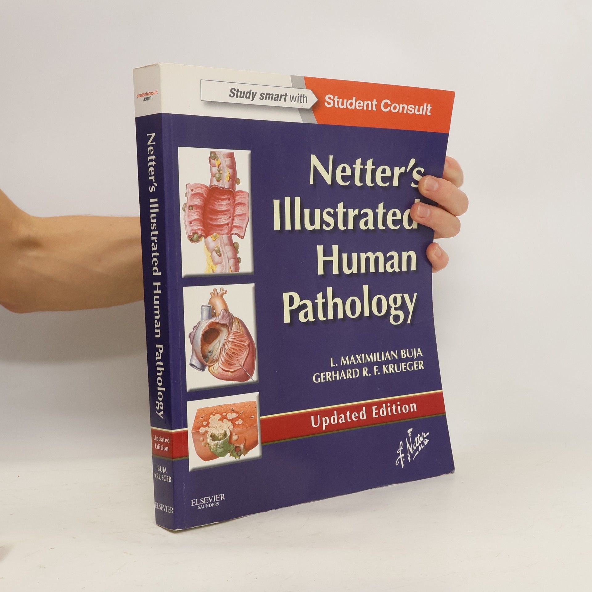 L. Maximilian Buja Netter's Illustrated Human Pathology Updated Edition