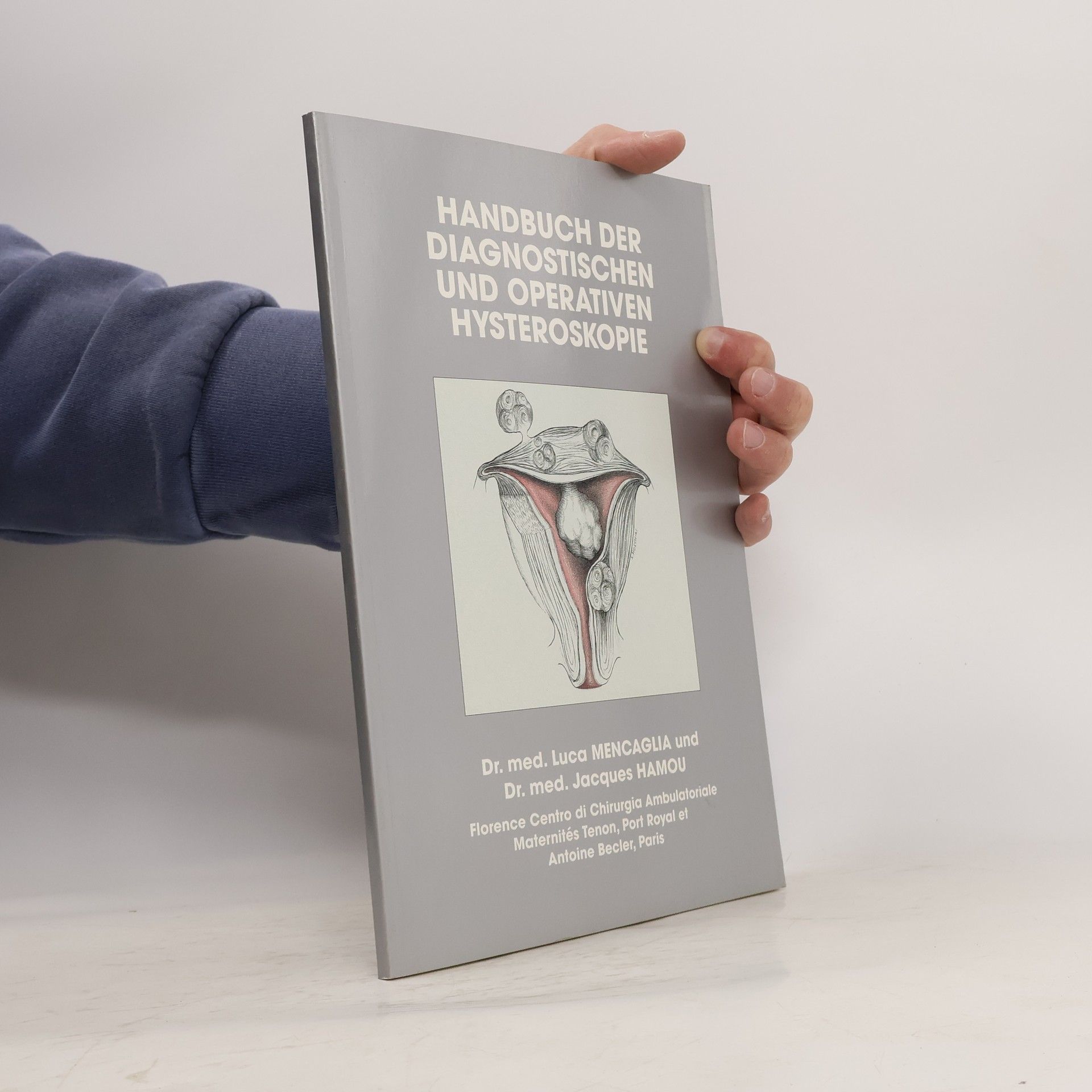Luca Mencaglia Handbuch der diagnostischen und operativen Hysteroskopie