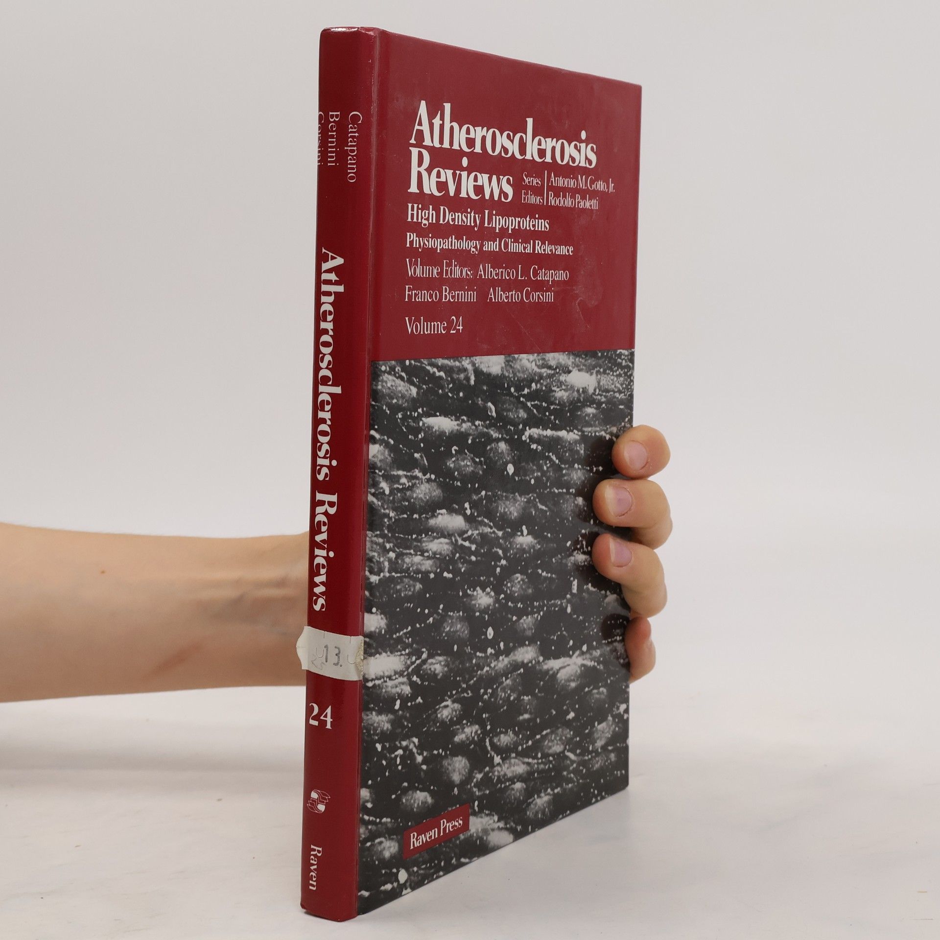 Collectif d'auteurs Atherosclerosis Reviews. High Density Lipoproteins