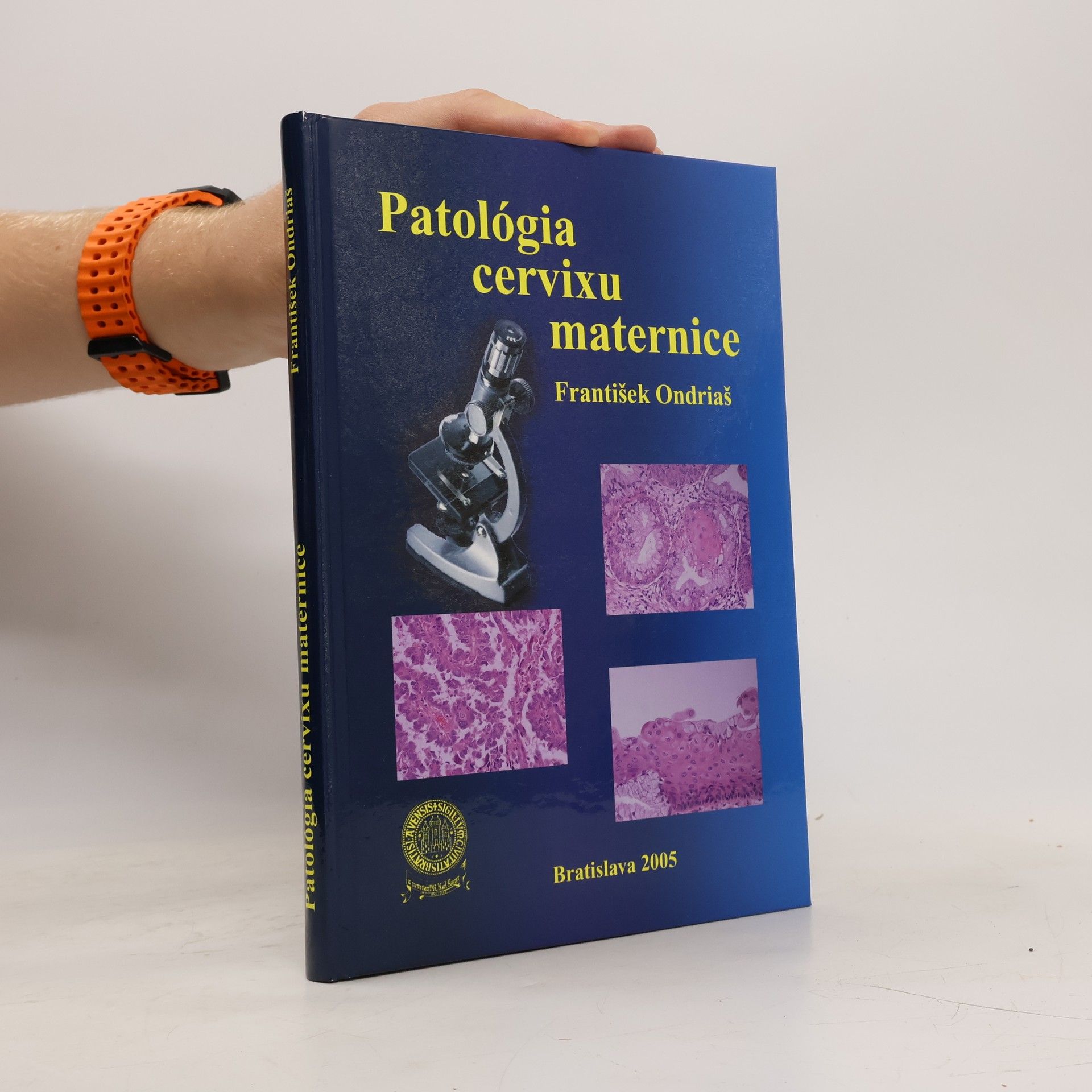František Ondriaš Patológia cervixu maternice