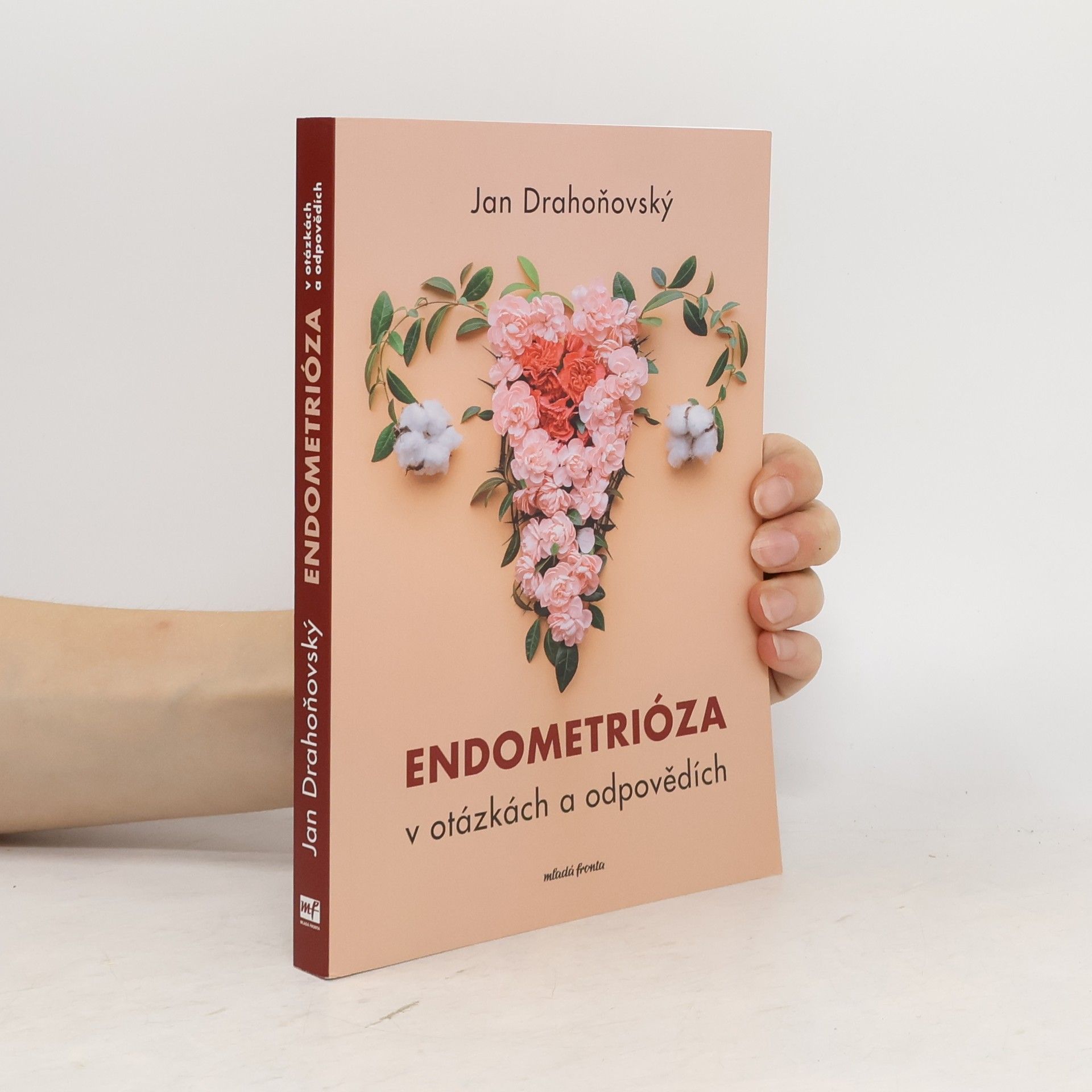 Jan Drahoňovský Endometrióza v otázkách a odpovědích