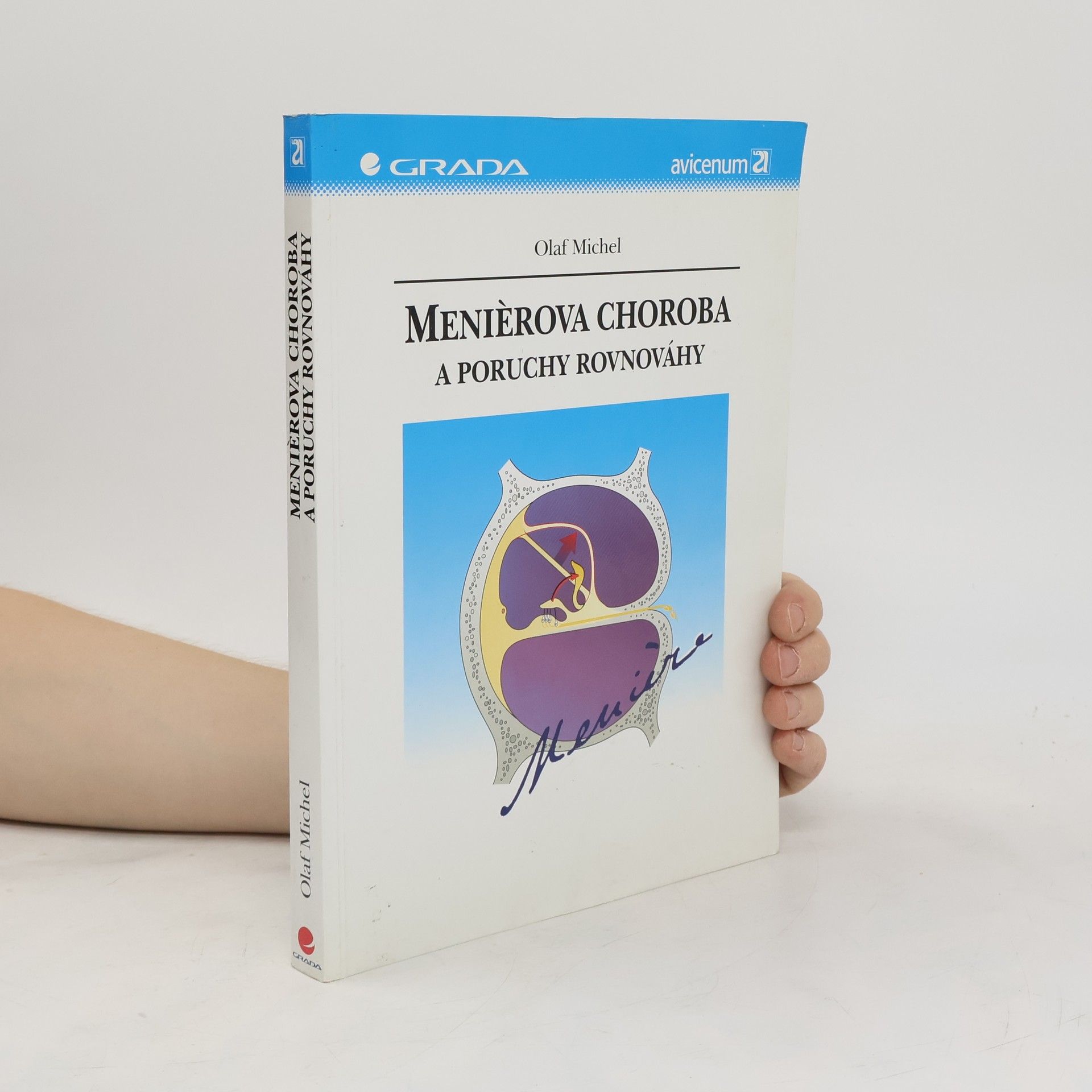 Michel Olaf Meniérova choroba a poruchy rovnováhy