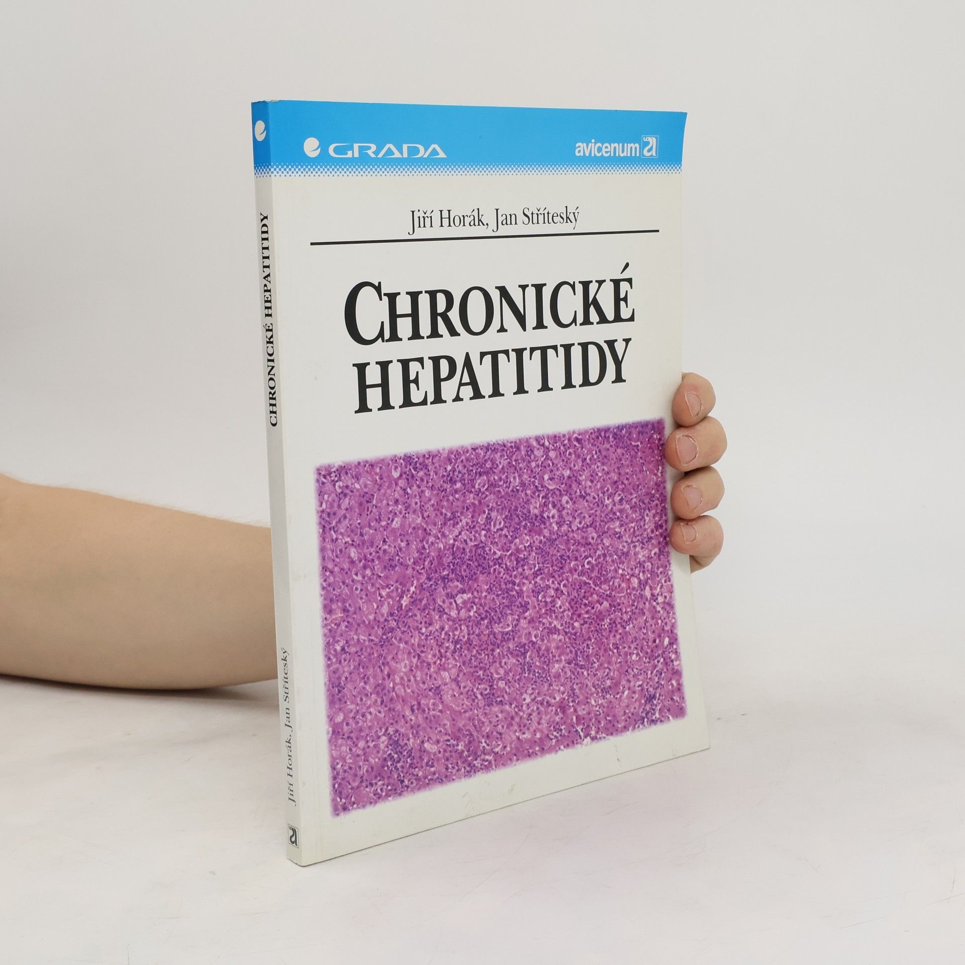 Jan Stříteský Chronické hepatitidy