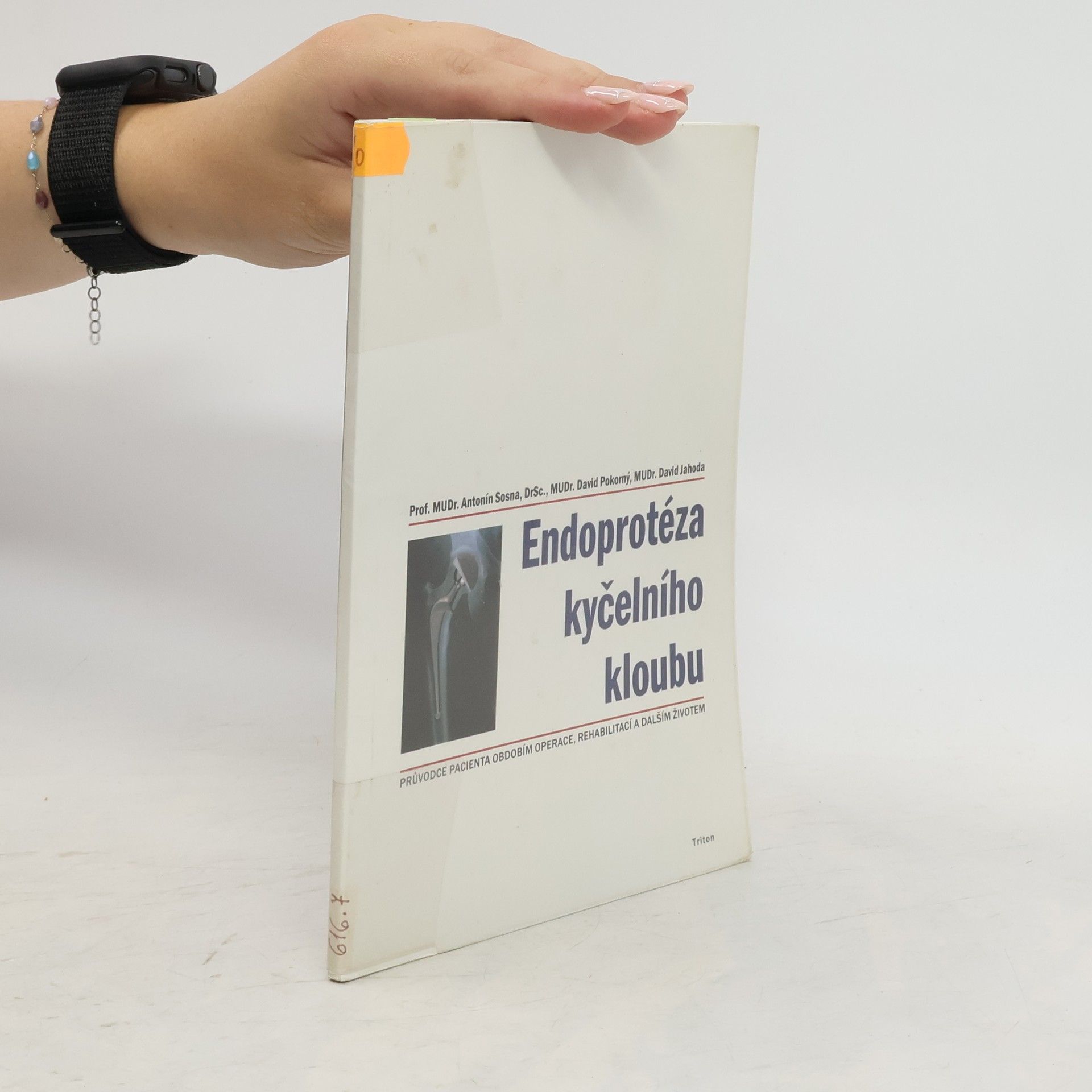 Antonín Sosna Endoprotéza kyčelního kloubu