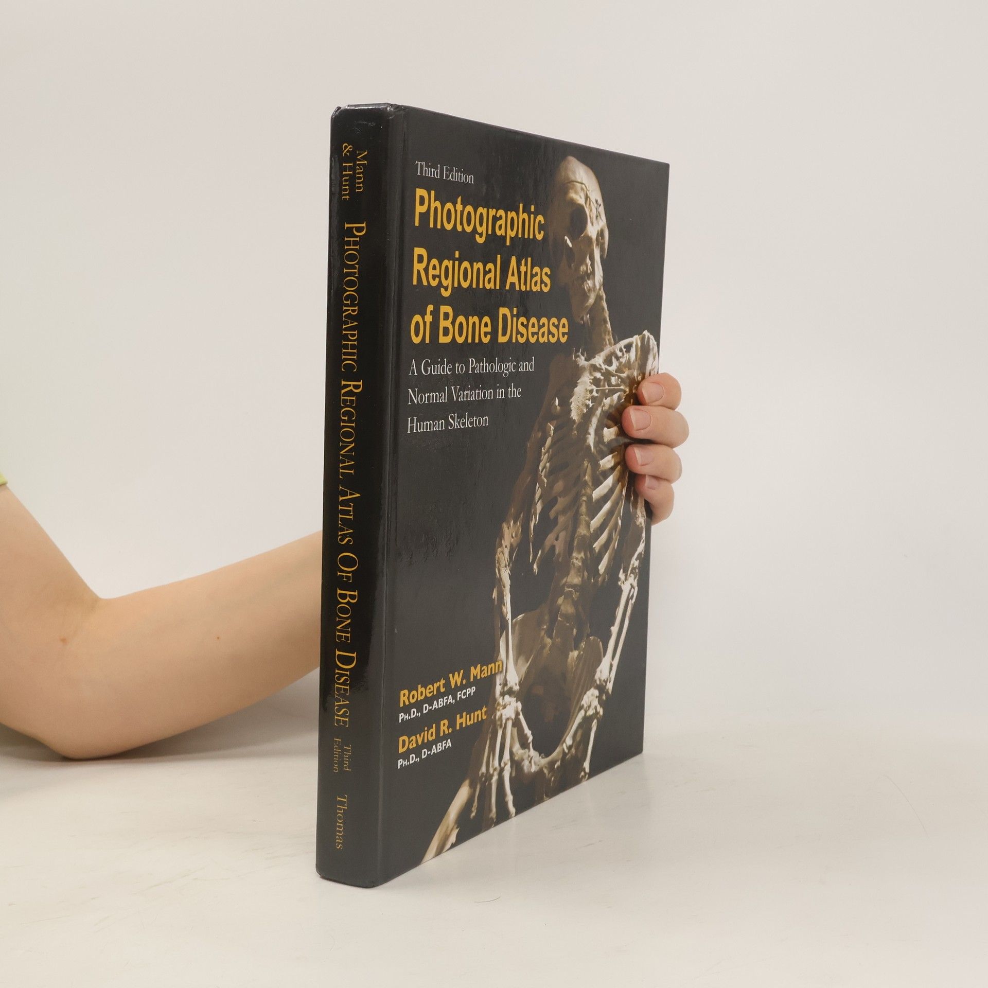 Robert W. Mann Photographic Regional Atlas of Bone Disease