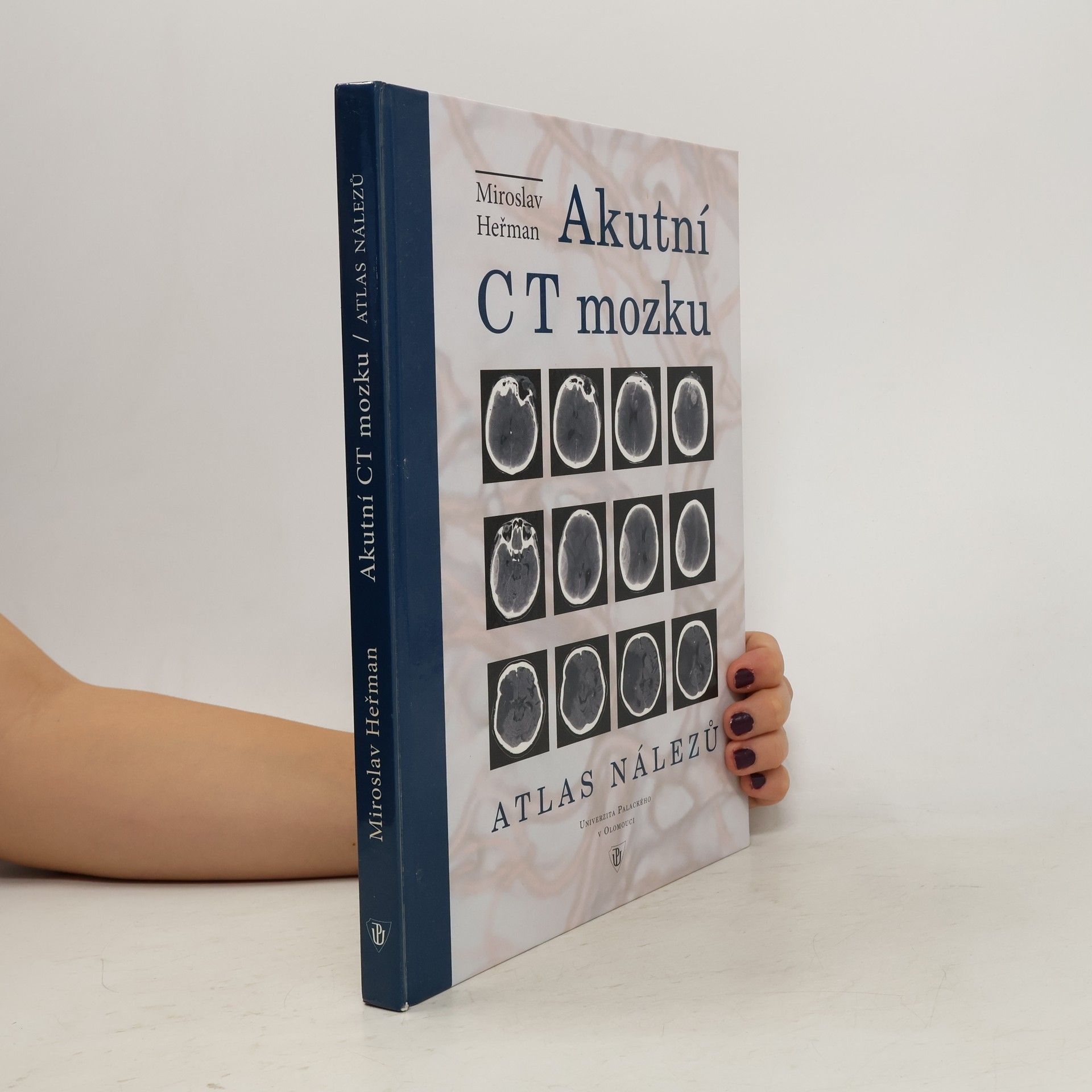 Miroslav Heřman Akutní CT mozku. Atlas nálezů