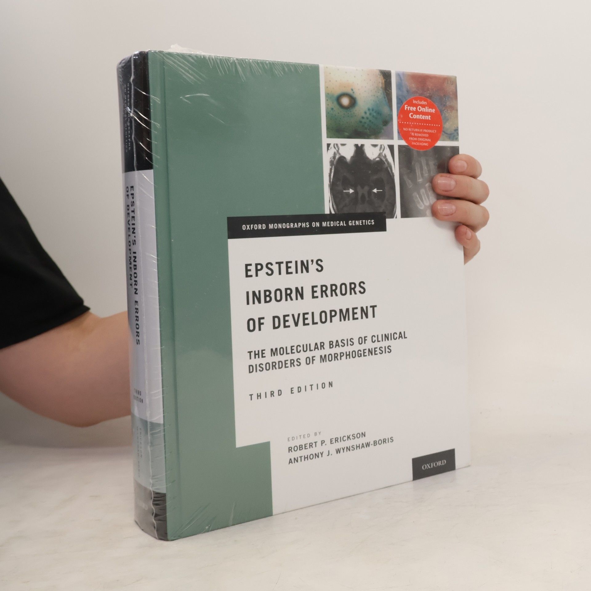 Robert P. Erickson Epstein's Inborn Errors of Development