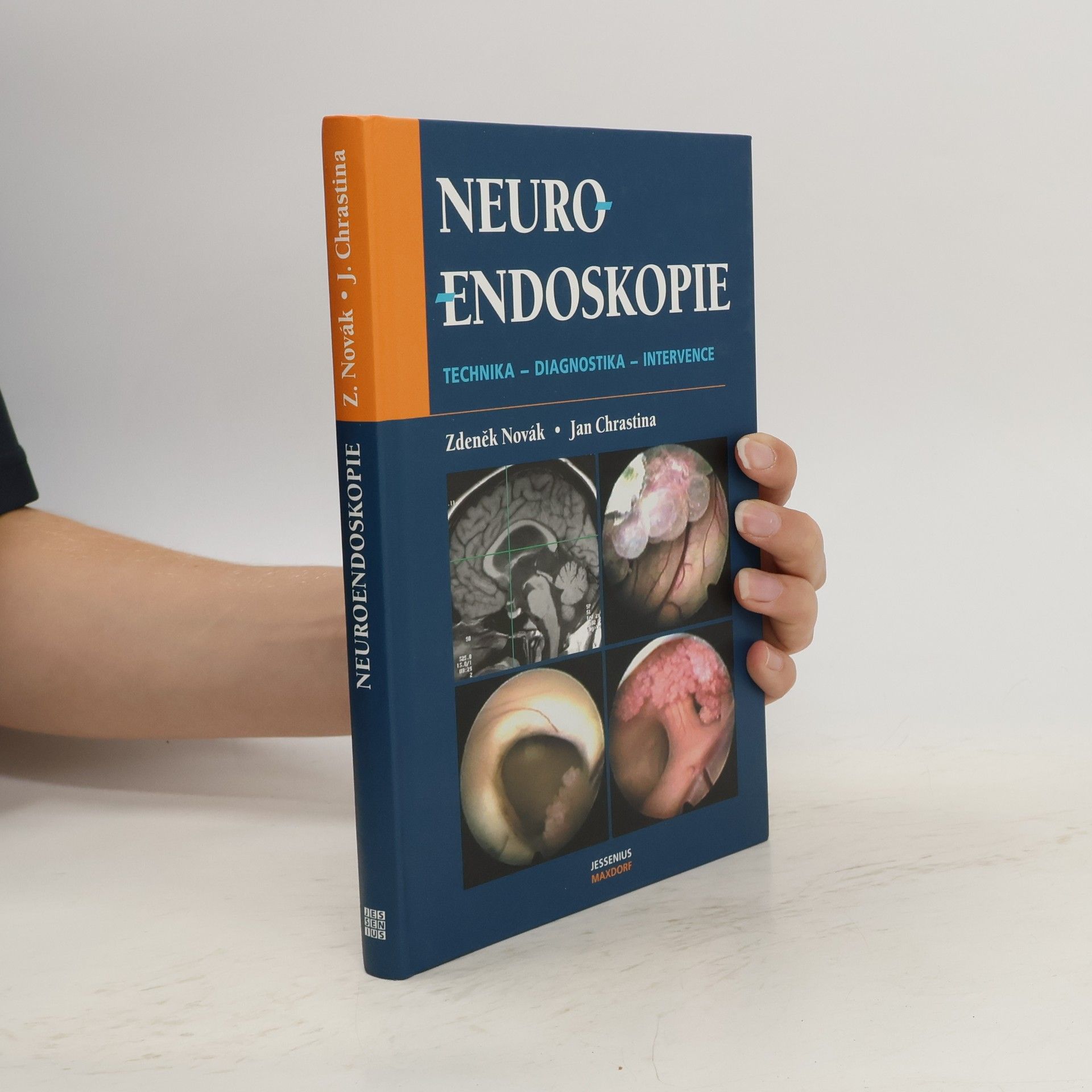 Zdeněk Novák Neuroendoskopie