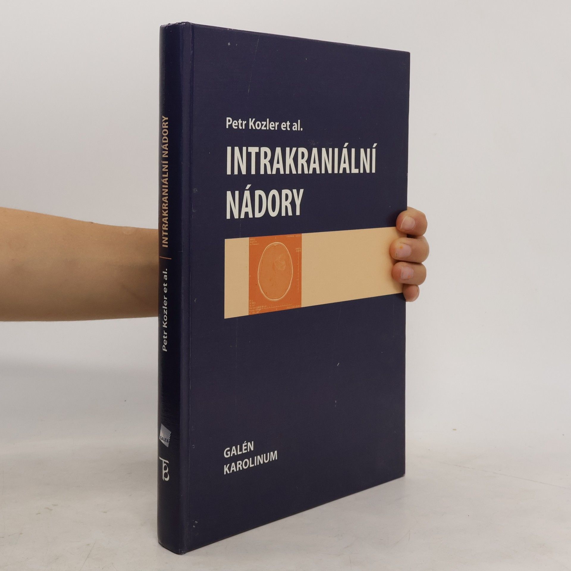 Petr Kozler Intrakraniální nádory
