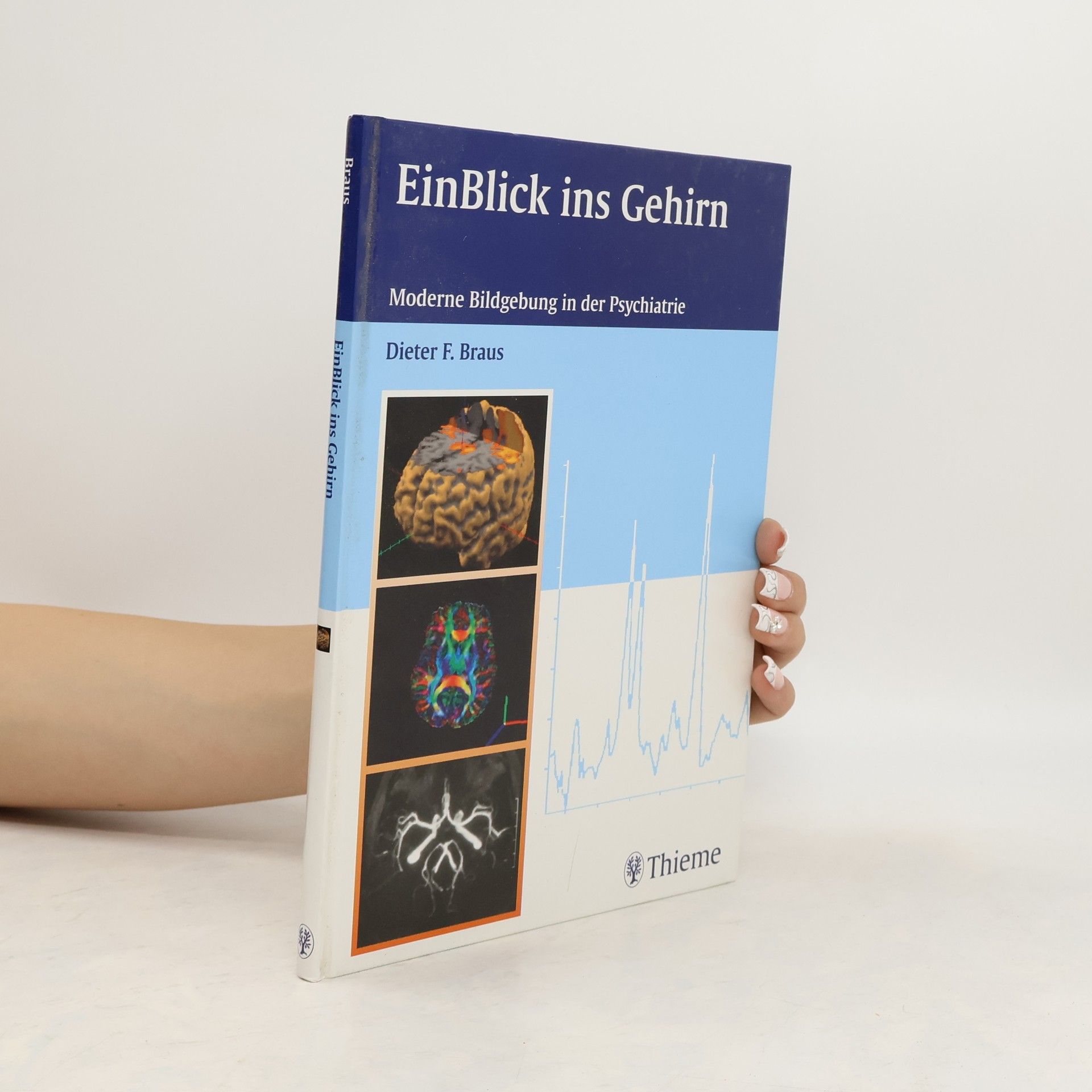 Dieter F. Braus EinBlick ins Gehirn
