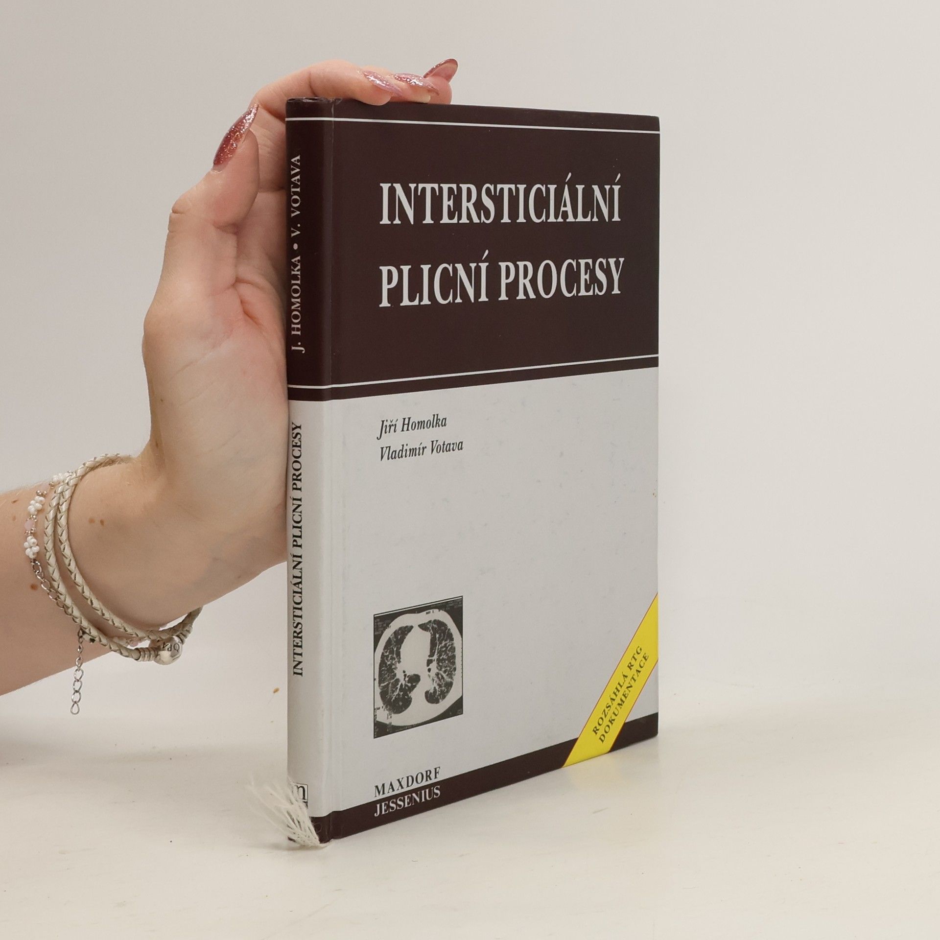 Jiří Homolka Intersticiální plicní procesy