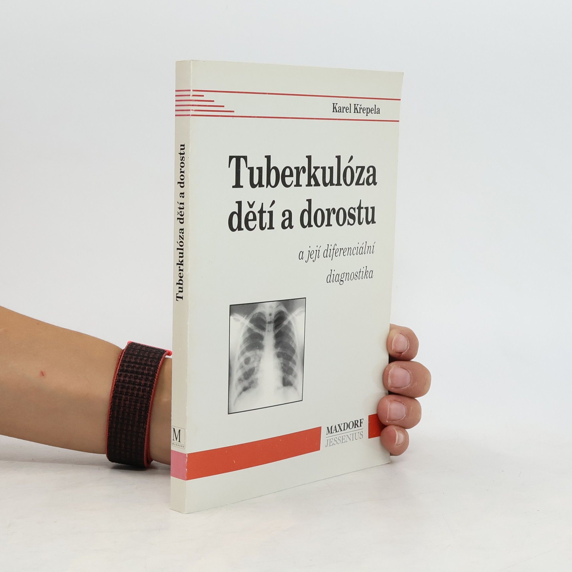 Karel Křepela Tuberkulóza dětí a dorostu a její diferenciální diagnostika