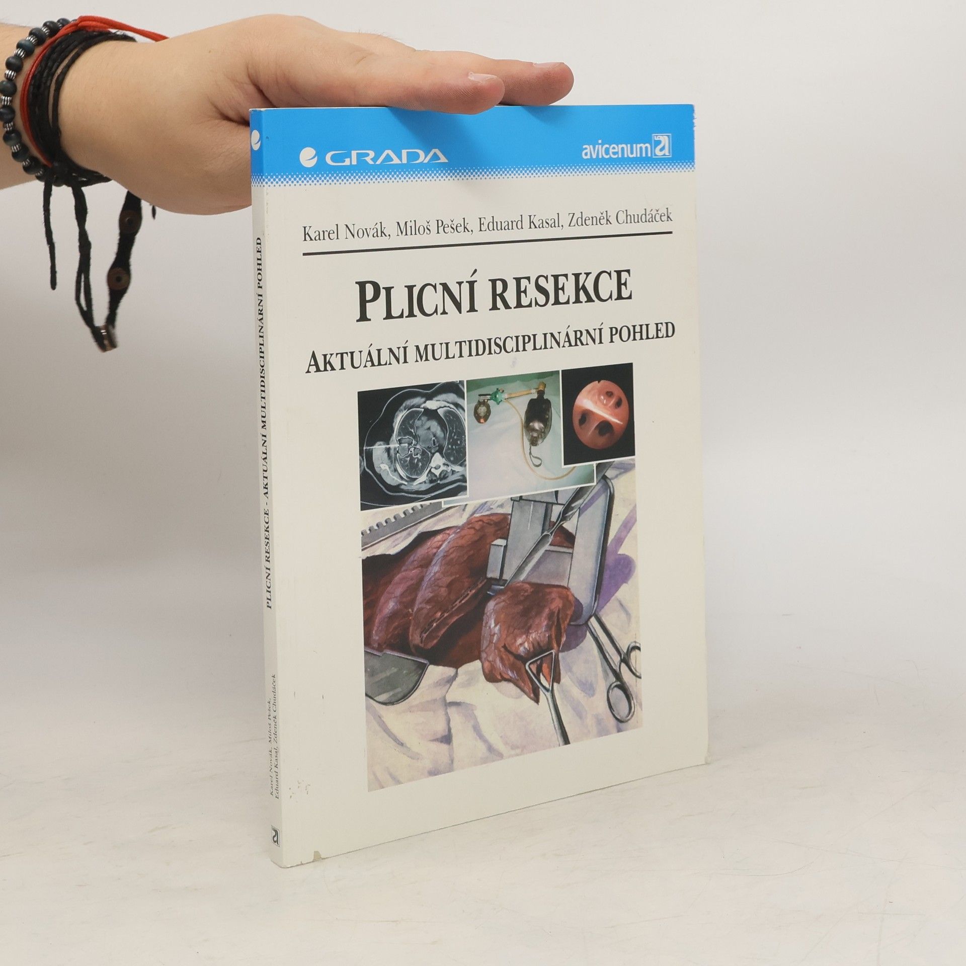 Karel Novák Plicní resekce : aktuální multidisciplinární pohled