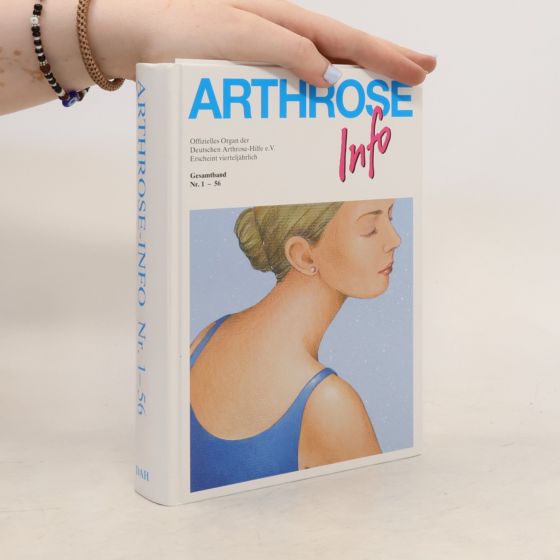 Autorenkollektiv Arthrose-Info Nr. 1-56