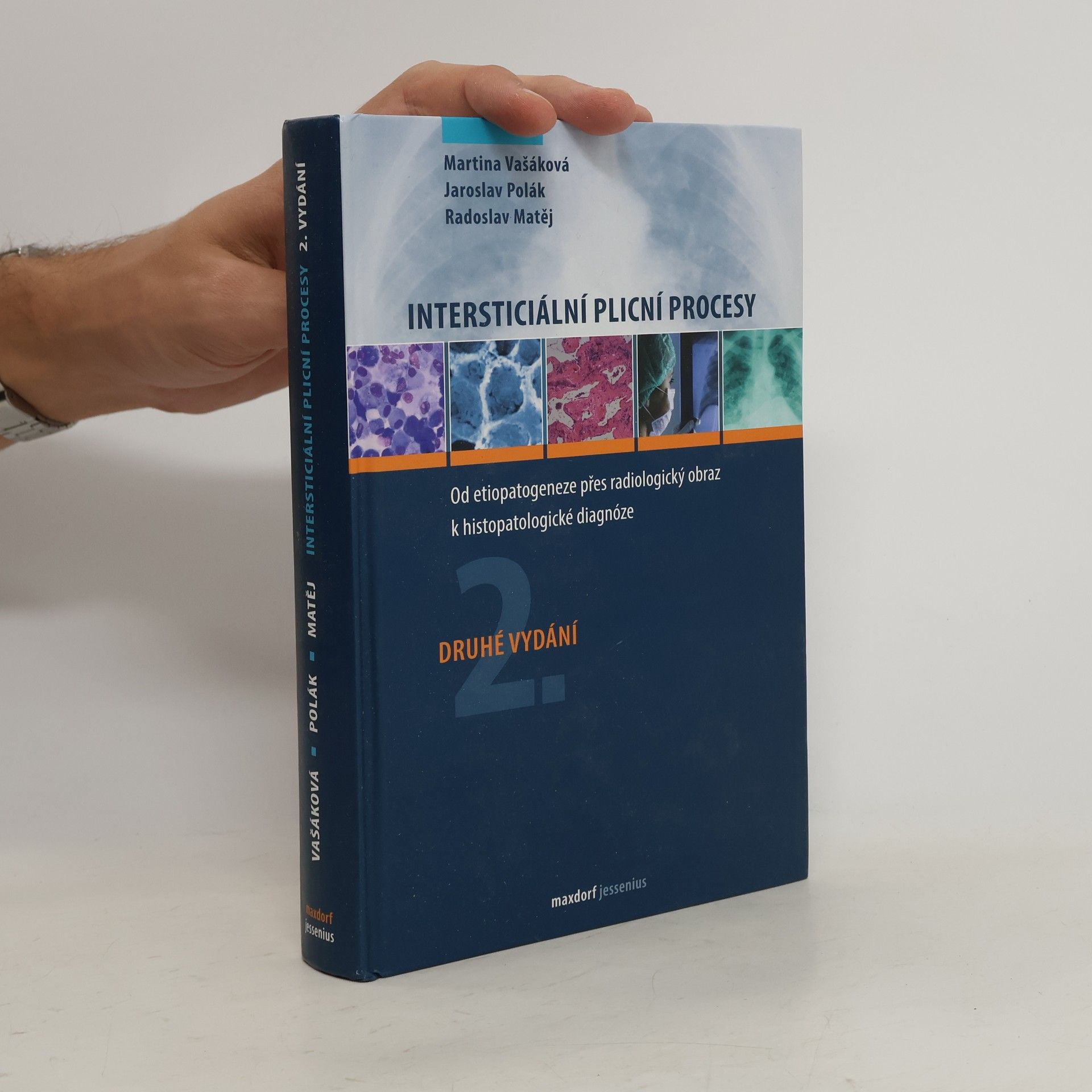 Martina Vašáková Intersticiální plicní procesy