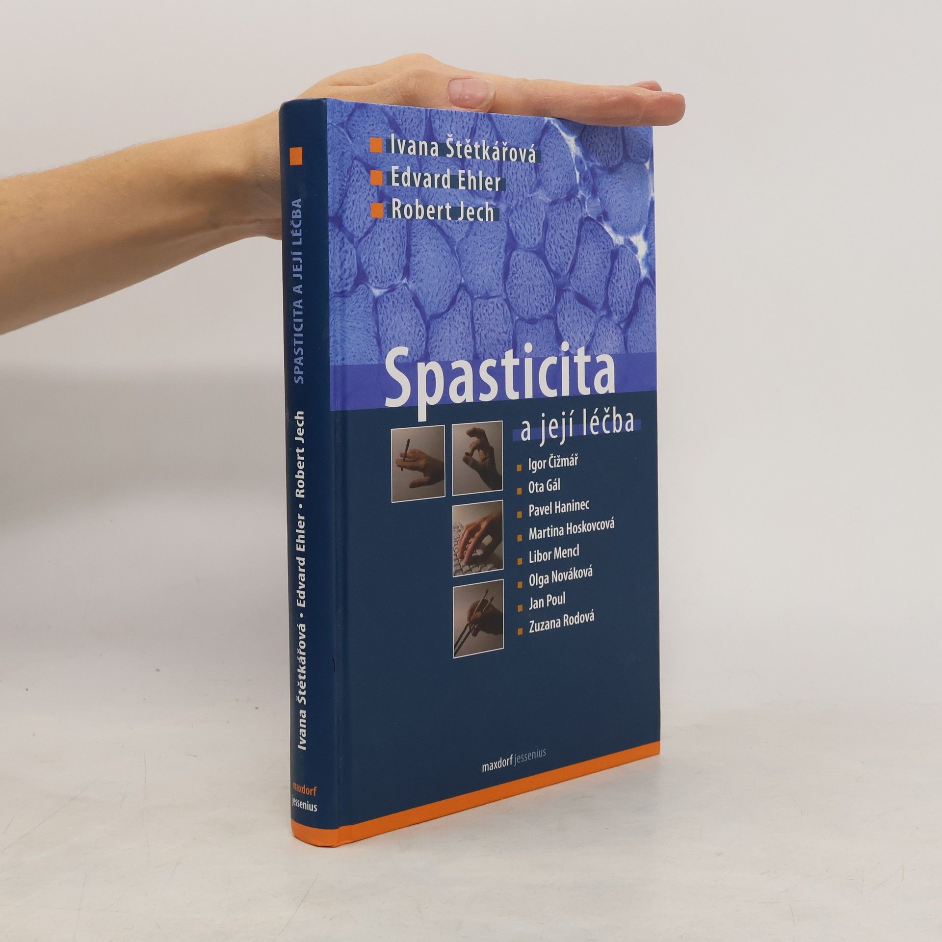 Ivana Štětkářová Spasticita a její léčba