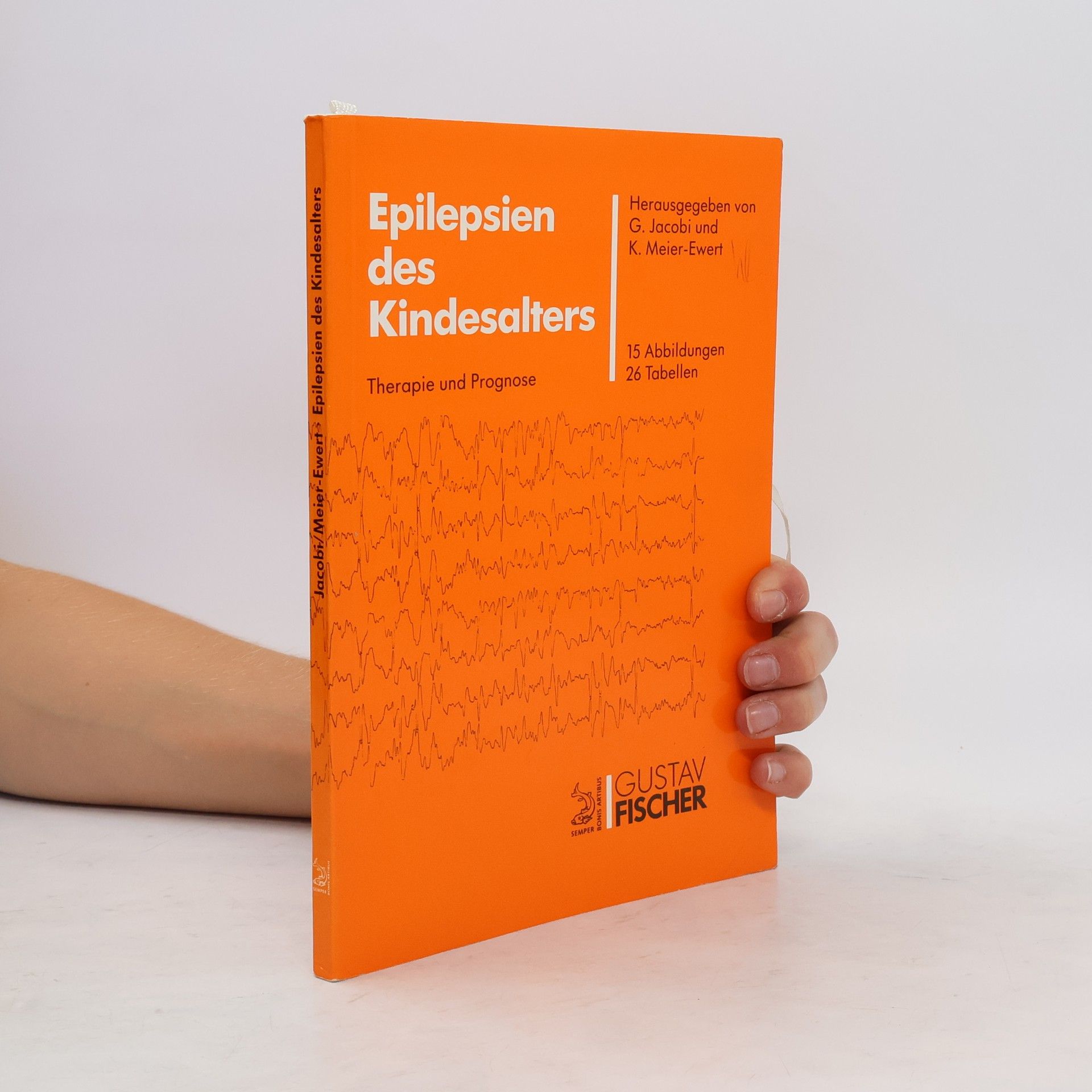 Gert Jacobi Epilepsien des Kindesalters