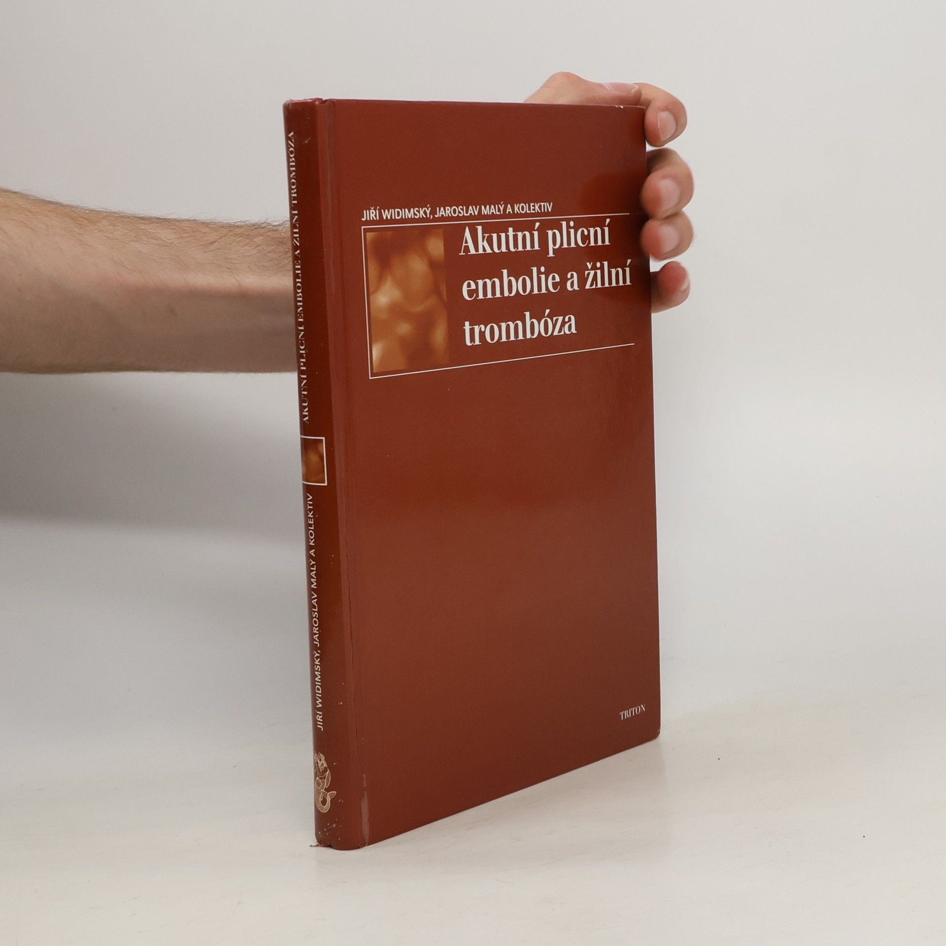 Jiří Widimský Akutní plicní embolie a žilní trombóza