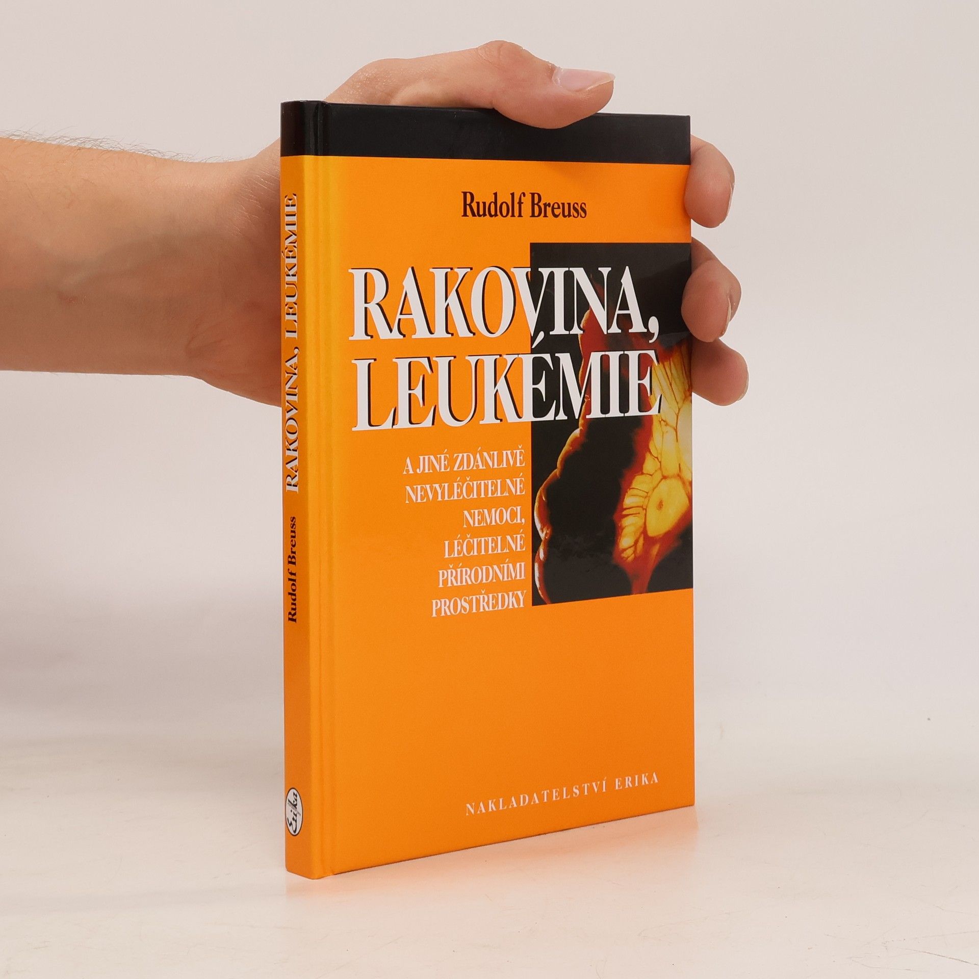 Rudolf Breuss Rakovina, leukémie a jiné zdánlivě nevyléčitelné nemoci, léčitelné přírodními prostředky