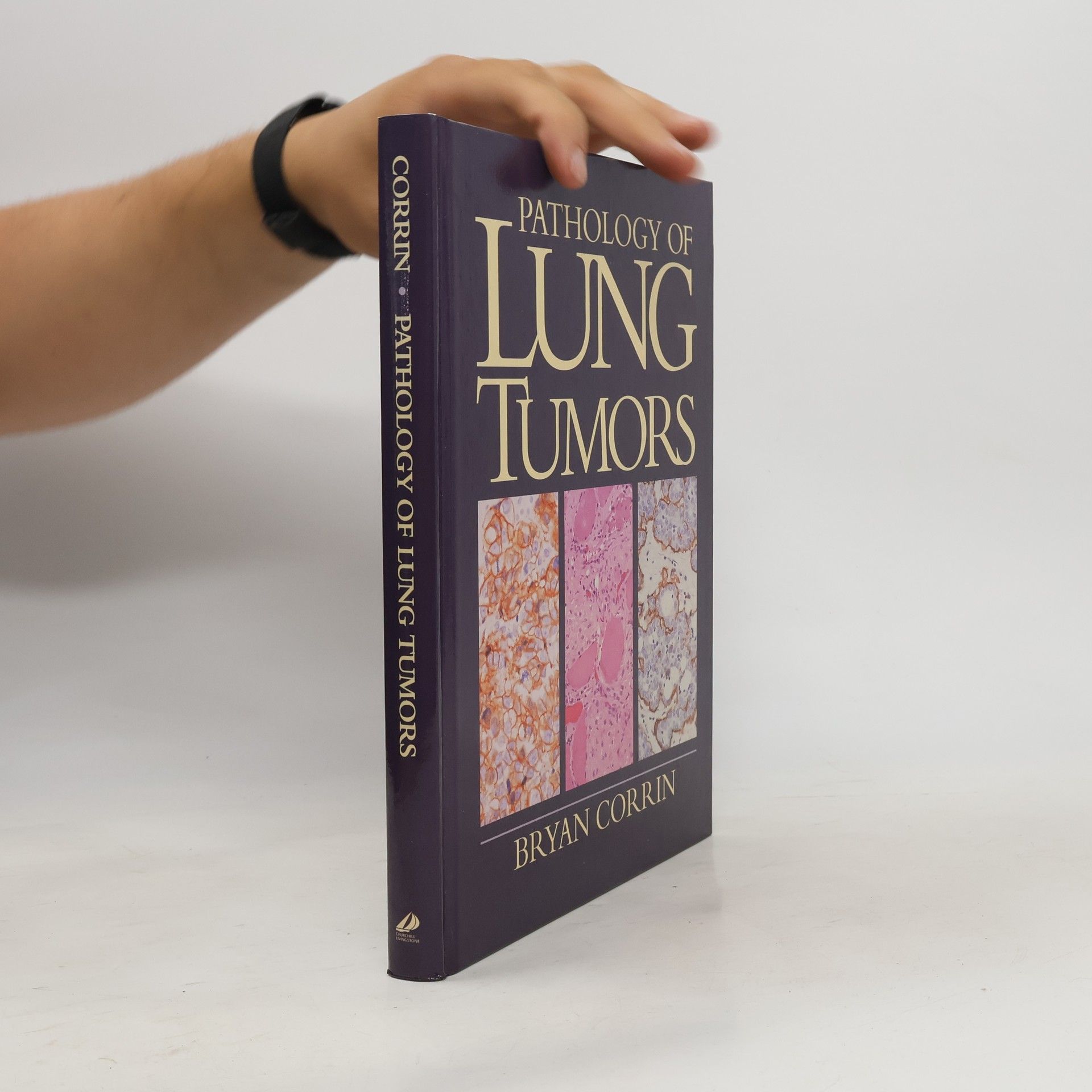 Bryan Corrin Pathology of Lung Tumors