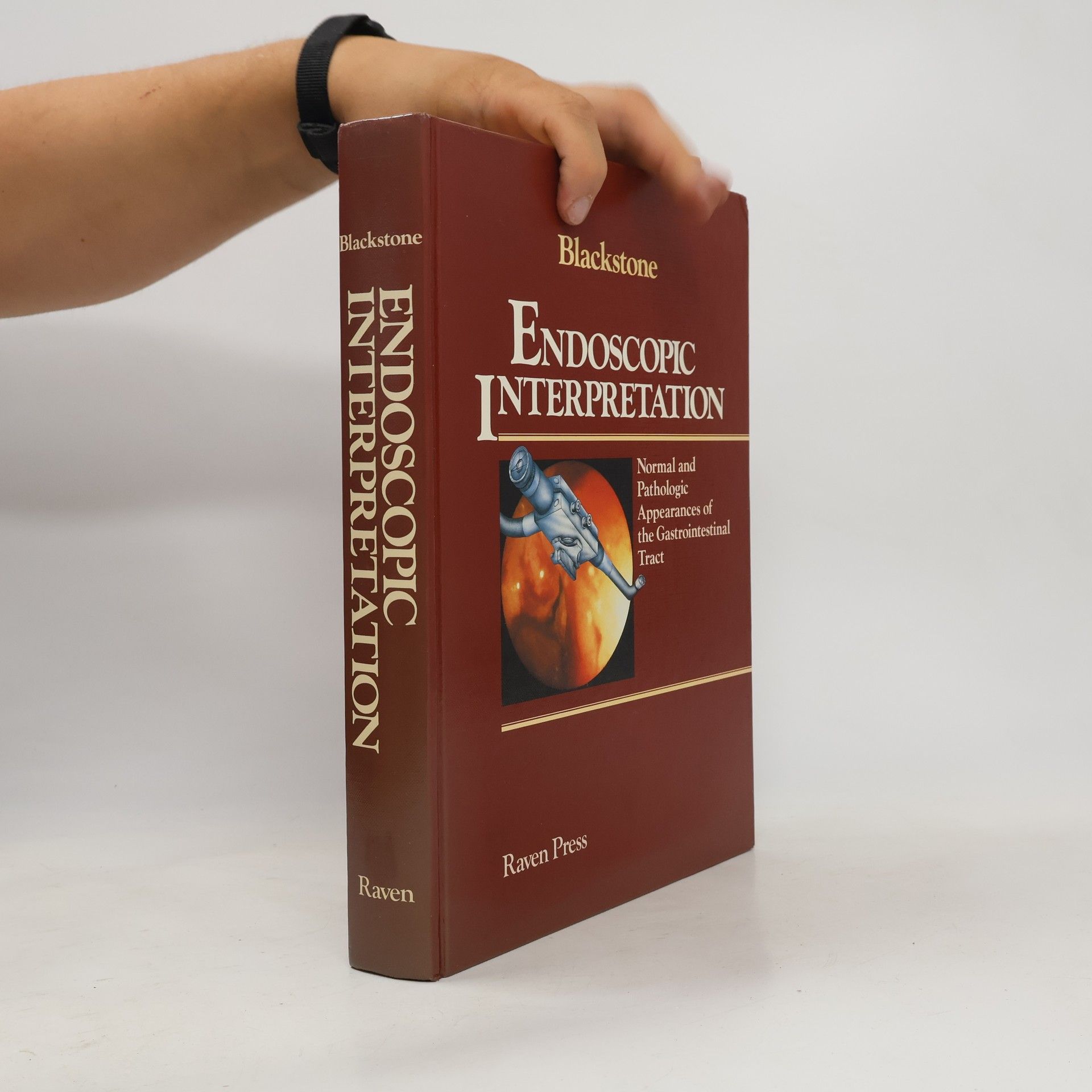 Michael O Blackstone Endoscopic Interpretation