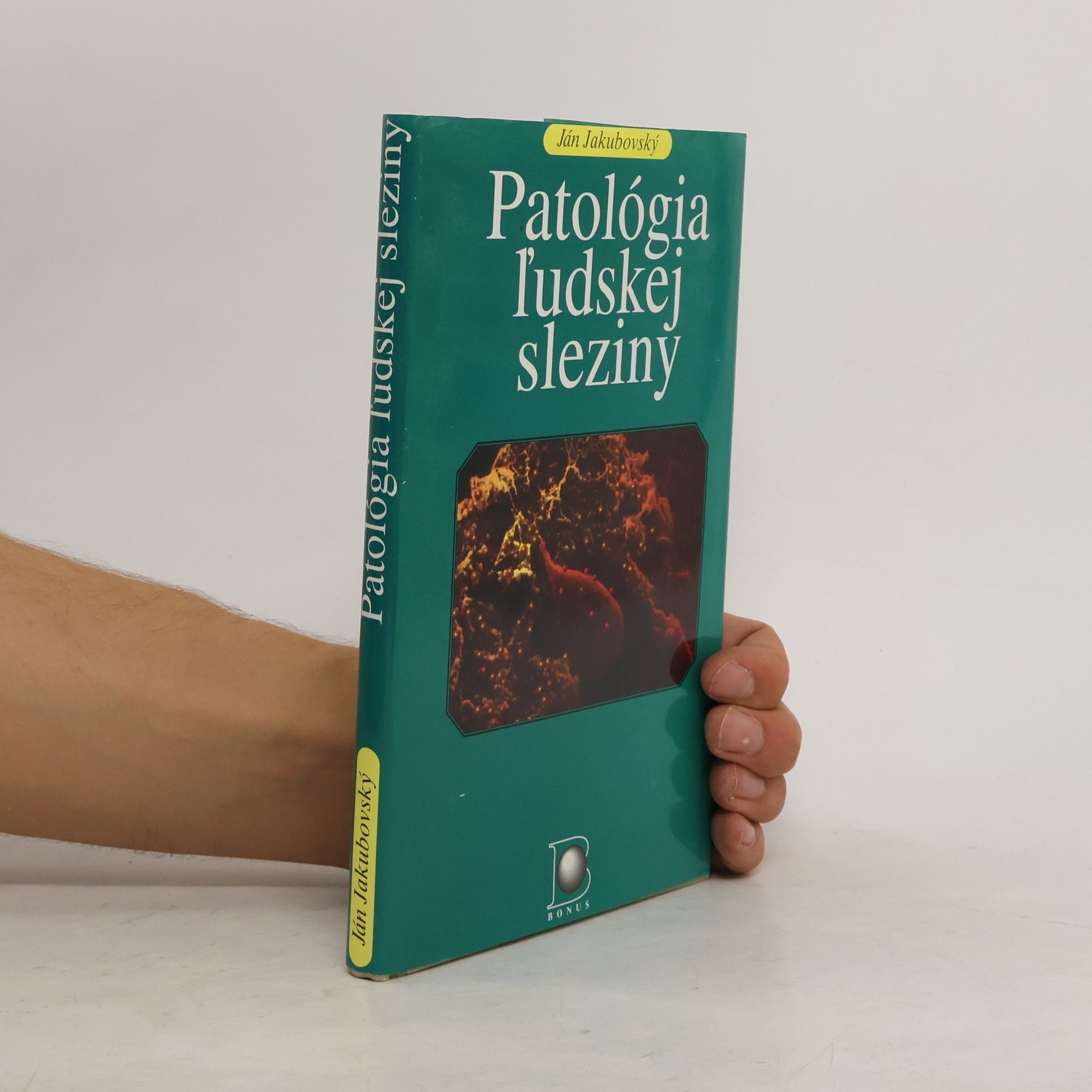 Ján Jakubovský Patológia ľudskej sleziny