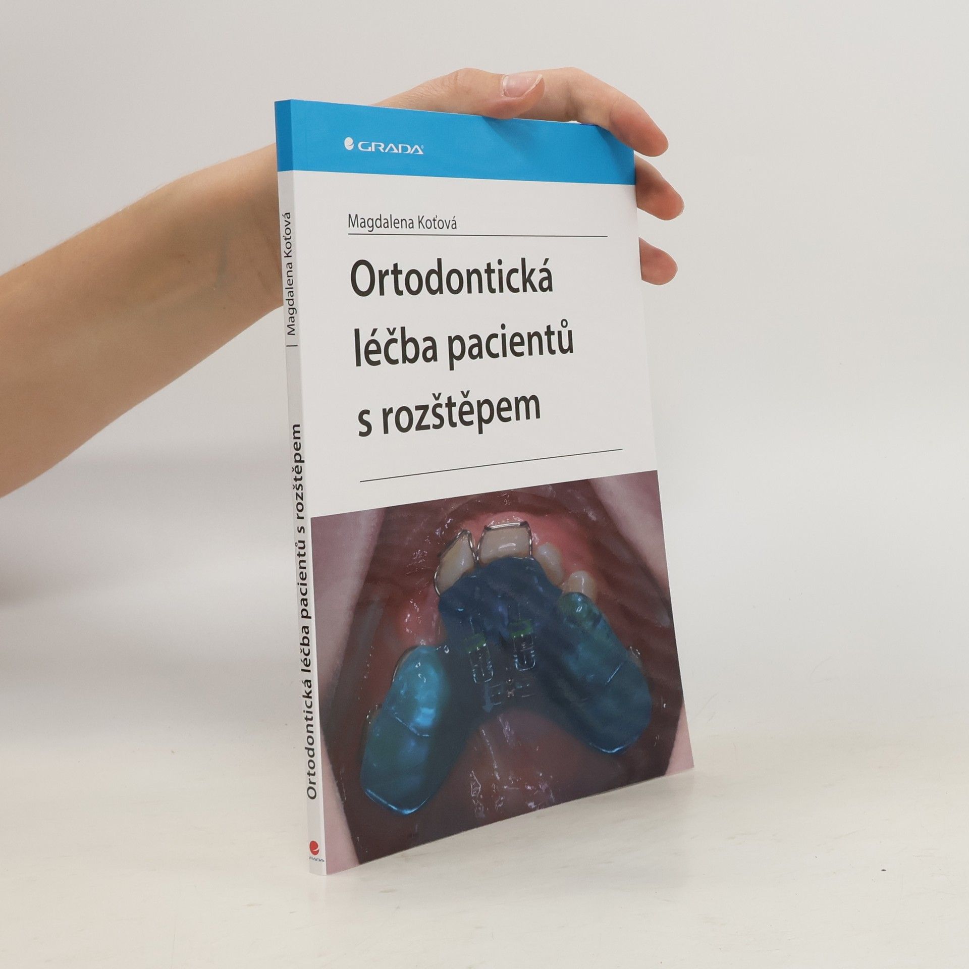Magdalena Koťová Ortodontická léčba pacientů s rozštěpem