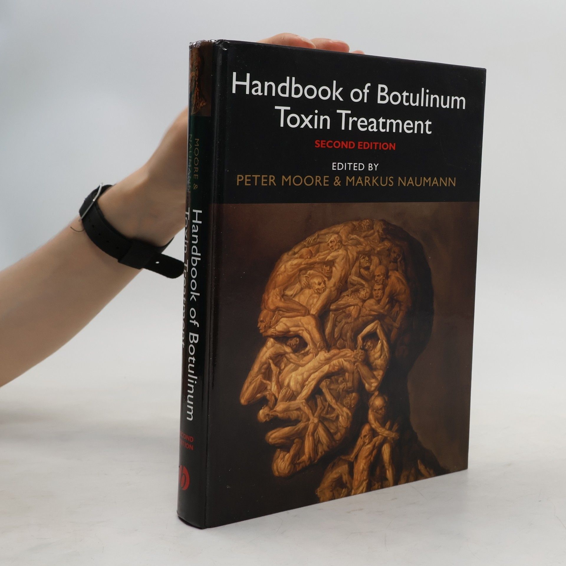 Markus Naumann Handbook of Botulinum Toxin Treatment
