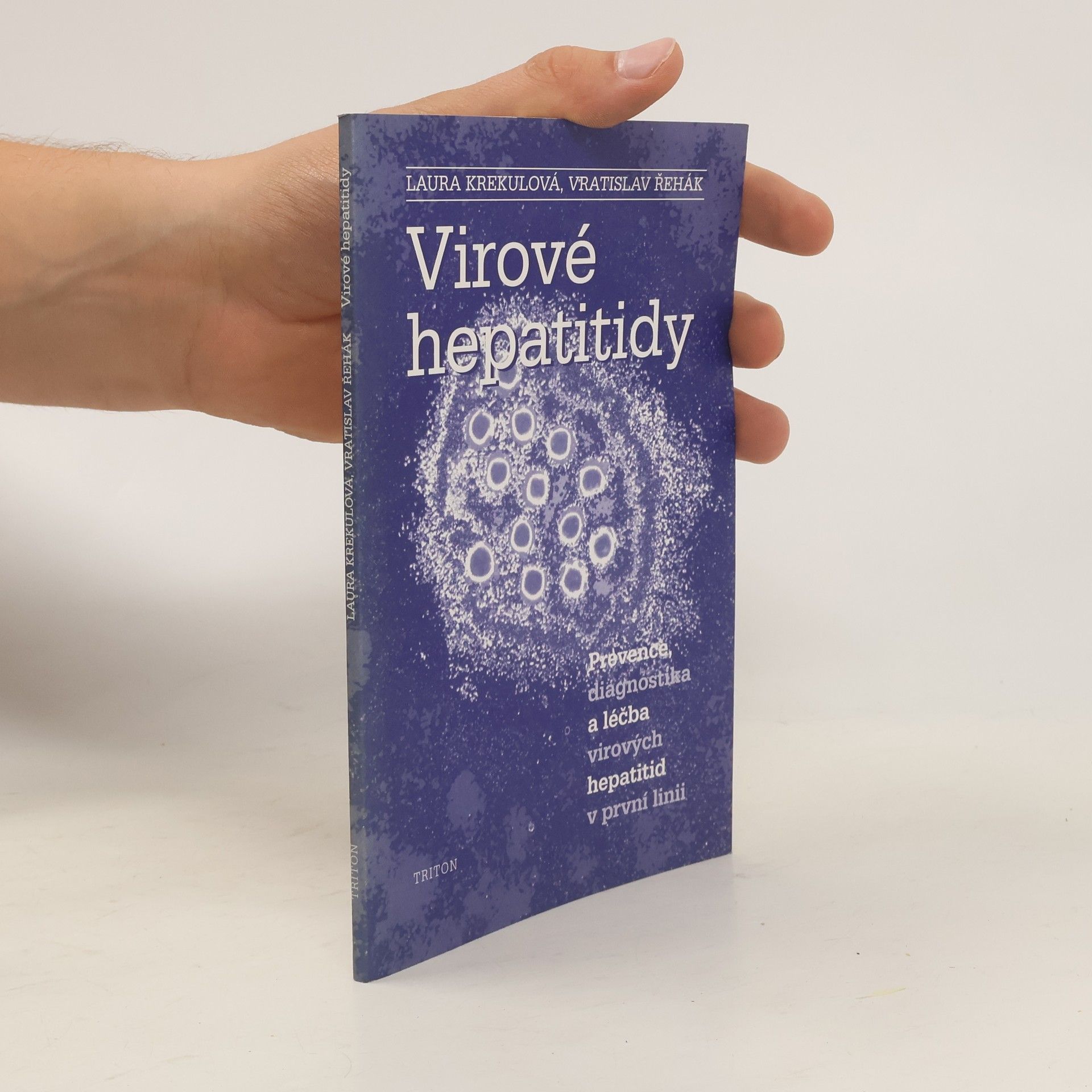 Laura Krekulová Virové hepatitidy