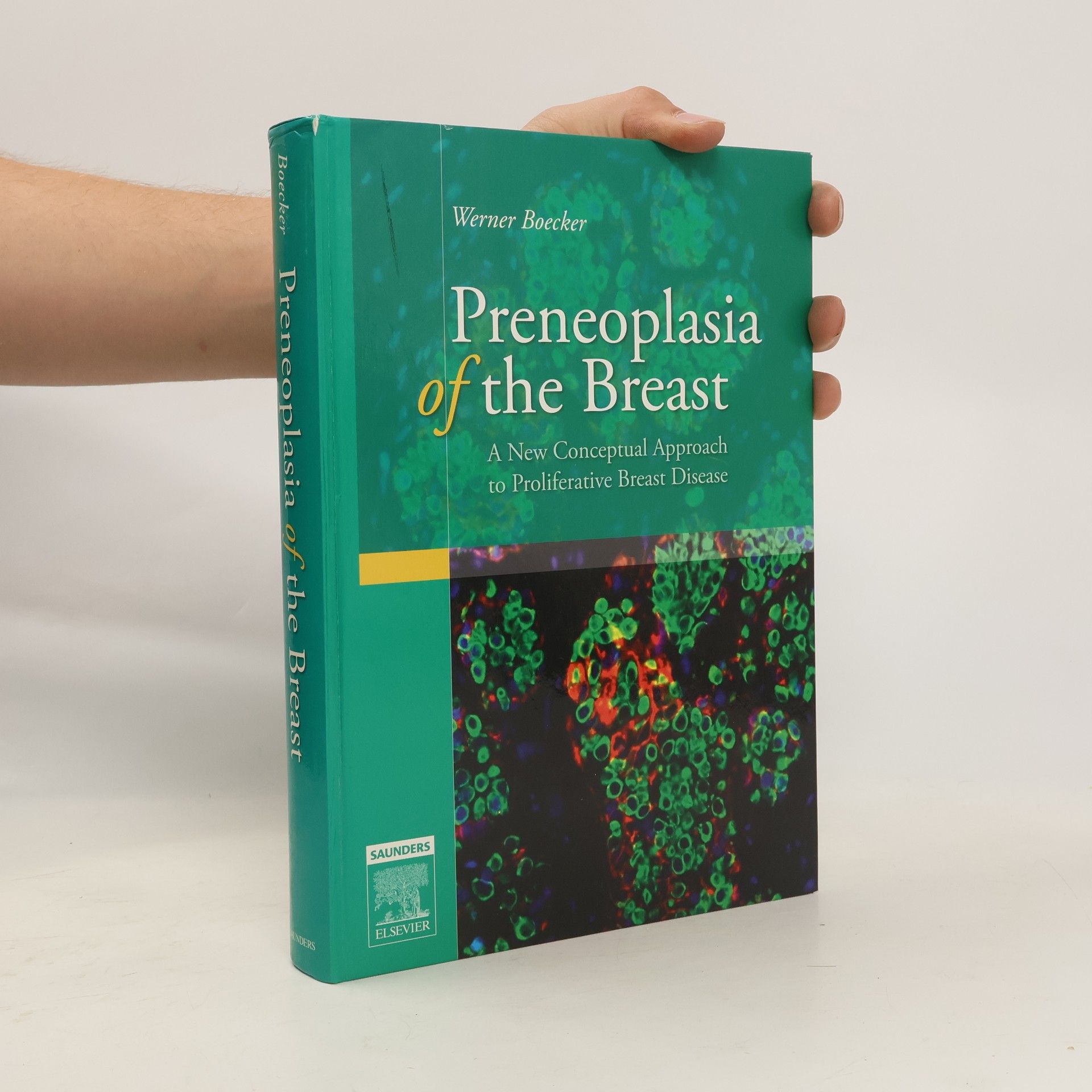 Werner Boecker Preneoplasia of the Breast