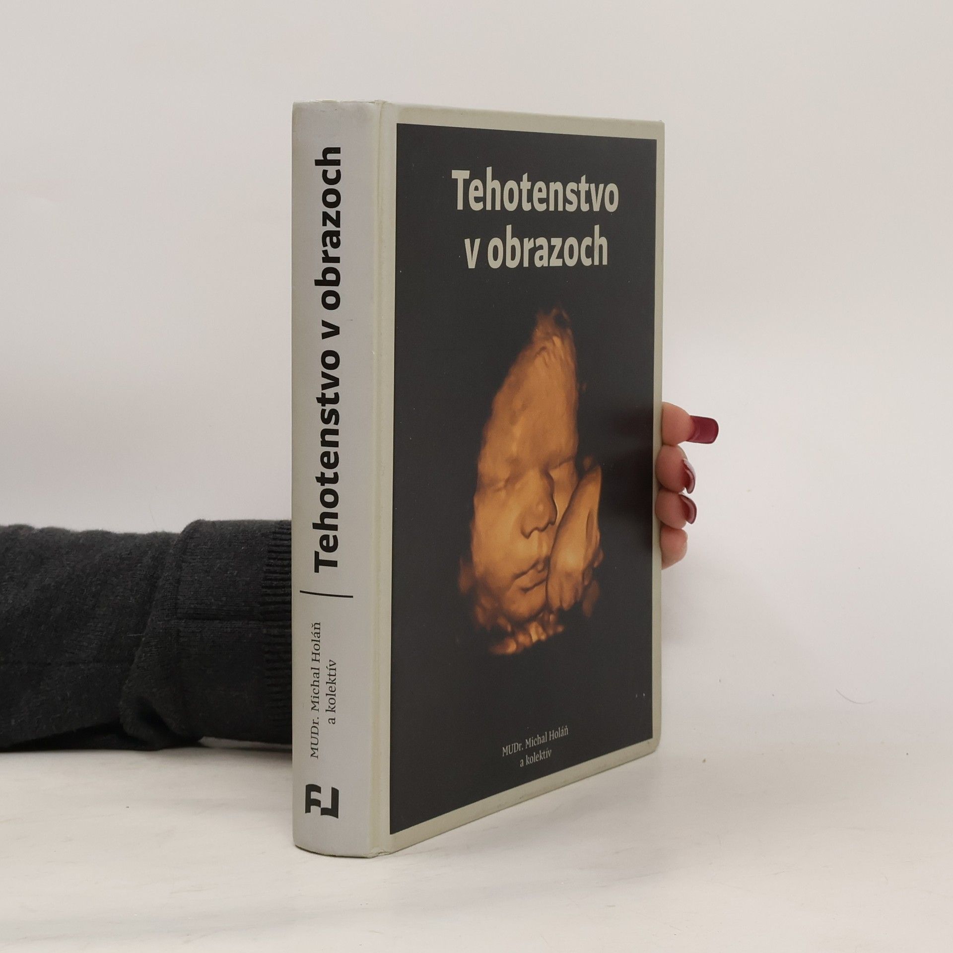 Collectif d'auteurs Tehotenstvo v obrazoch