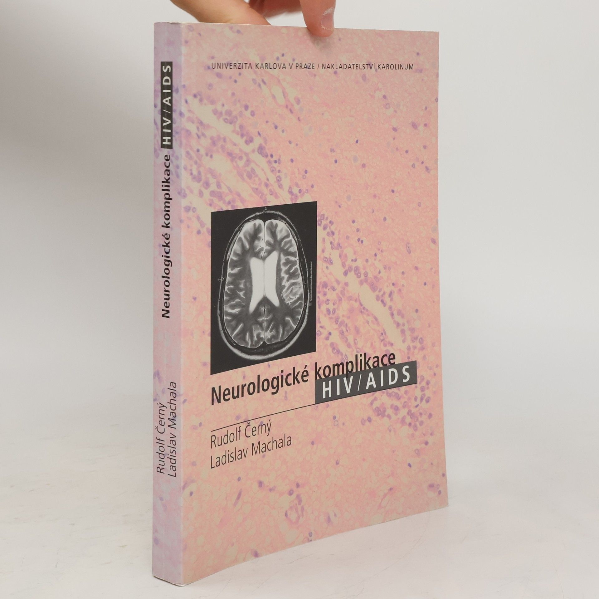 Ladislav Machala Neurologické komplikace HIV/AIDS