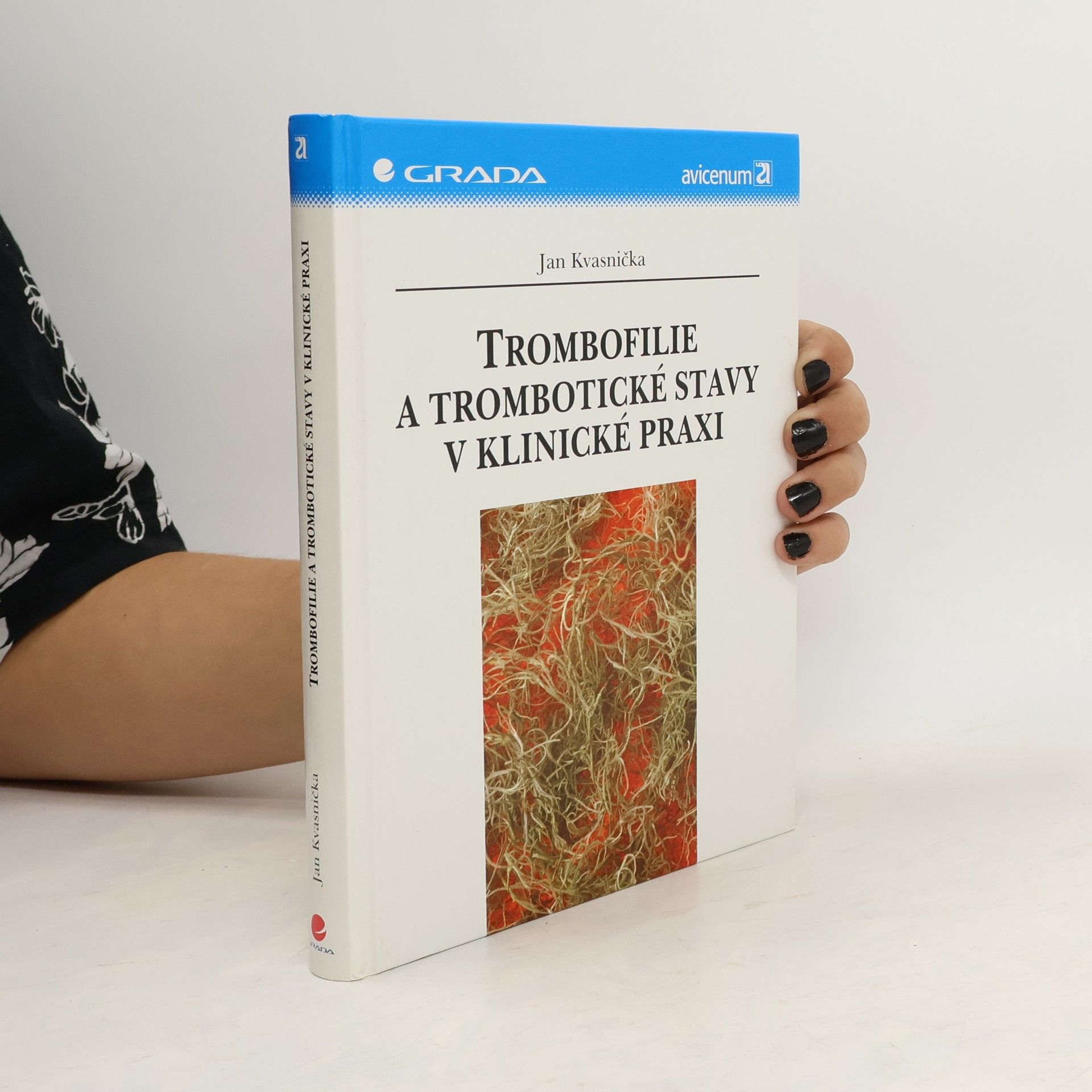 Trombofilie a trombotické stavy v klinické praxi